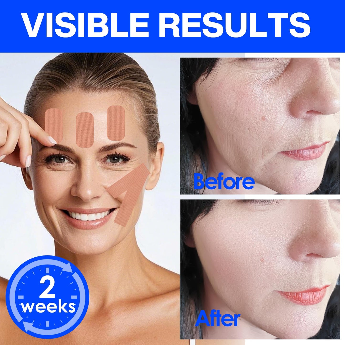 zancony Face Tape for Wrinkles Facial Myofascial Lift Patches for All Parts of the Face and Neck, Forehead 11 Lines Nasolabial Folds Crow's Feet Necklines etc, 2.5 CM* 2 Rolls - Pink