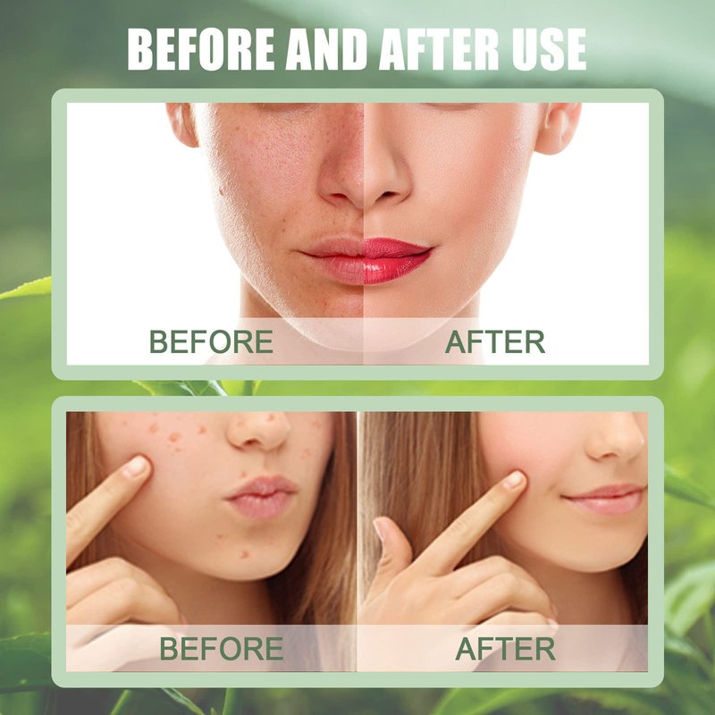 JISKG Green Tea Clay Mask Stick, Blackhead Remover with Green Tea Extract, Deep Pore Cleansing, Moisturizing, Oil Control for Men and Women All Skin.