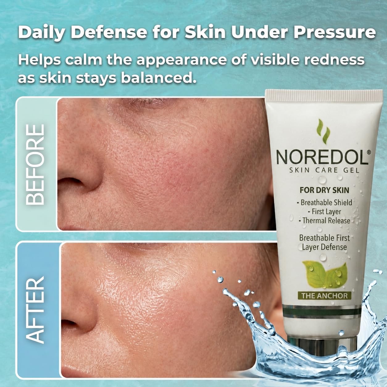 Noredol Barrier Repair Gel Moisturizer - Water Based Weightless Daily Defense for Sensitive Skin - Post Laser Post Peel Recovery - Aloe Vera & Panthenol Fragrance Free - Made in USA (1oz)