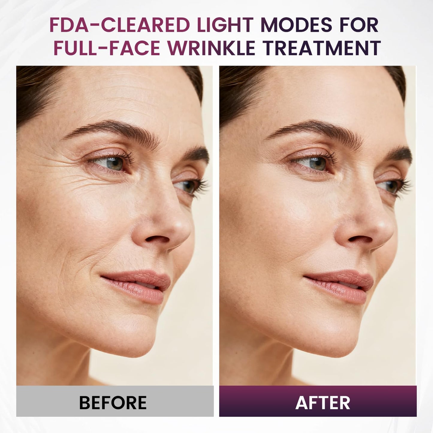 FDA Cleared Red Light Therapy Mask for Face, RB-008J LED Light Therapy Mask with Infrared/Blue/Red+Blue Modes for Wrinkles & Mild to Moderate Acne, Home-Use LED Face Mask