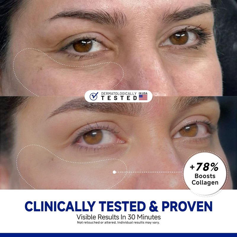 Dr Vincent Peptide Under Eye Patches, Firming Eye Patches Instant Reduces Dark Circles and Puffiness, Collagen Under Eye Mask for Bags Treatment, Wrinkles, 12 Pairs, Vegan