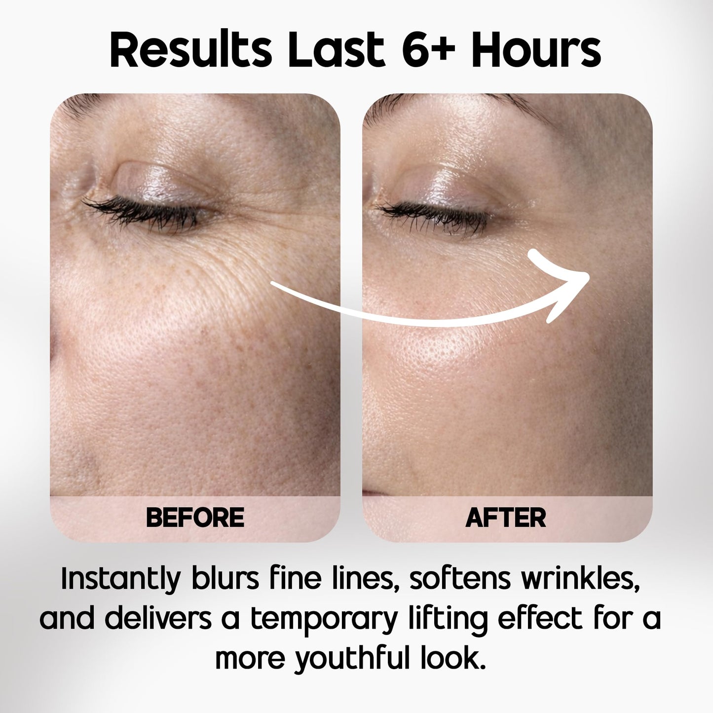 Celestolite Estrella Anti-Wrinkle Syringe