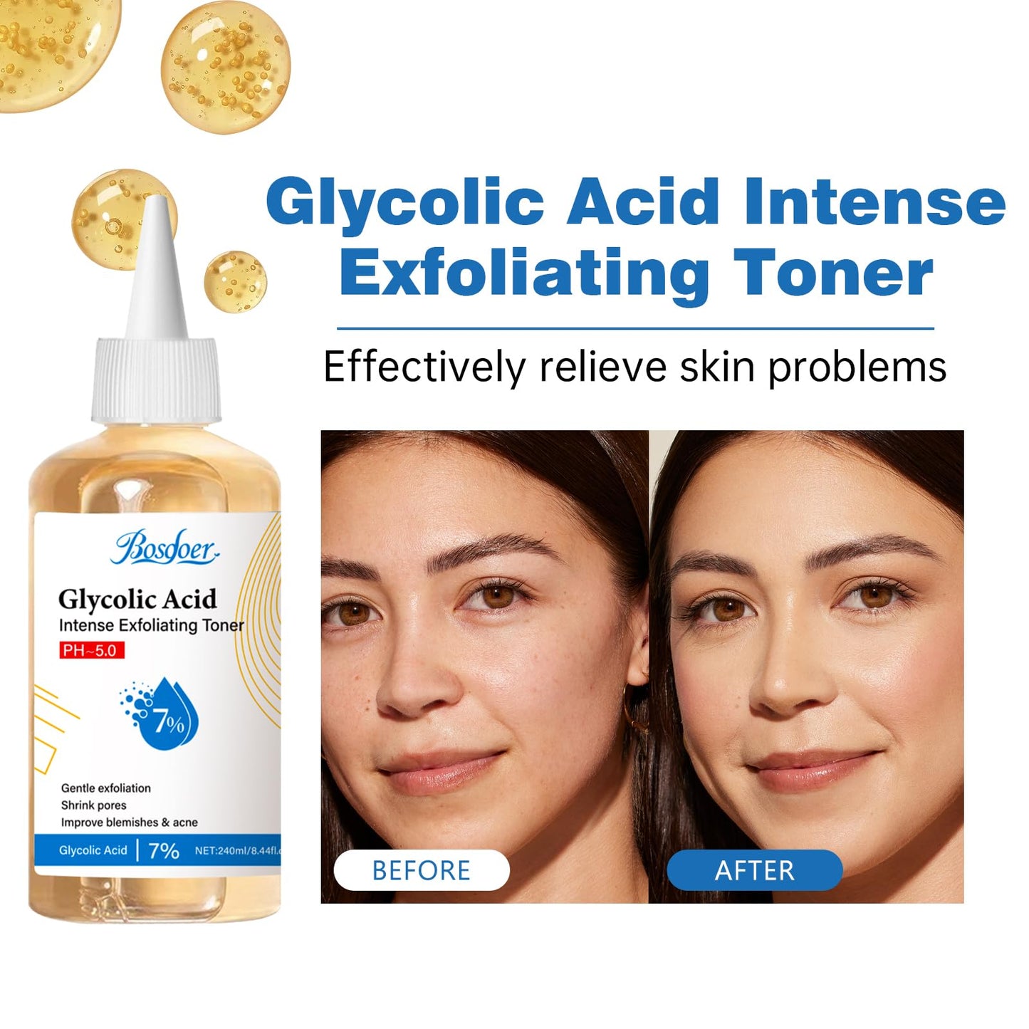 7% Glycolic Exfoliating Acid Toner, Even Skin Tone, Smooth Skin, Unclogs Pores, Gentle Effective Toner with Hydrating Properties for Daily Use