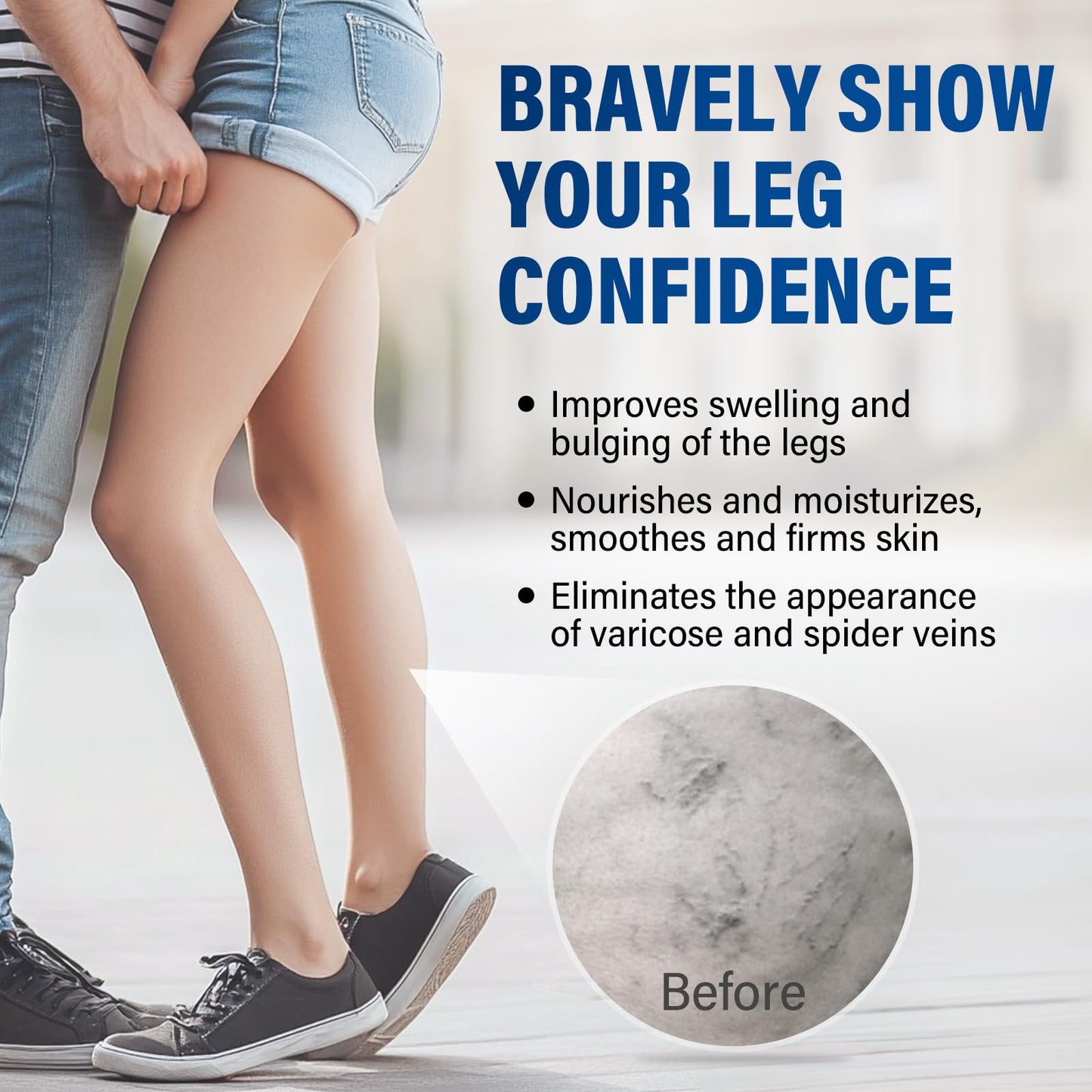 CURECURE Varicose Veins Treatment for Legs, Varicose Veins Treatment Cream- Improves Blood Circulation, Reduces Varicose Veins and Heaviness, 2 Count