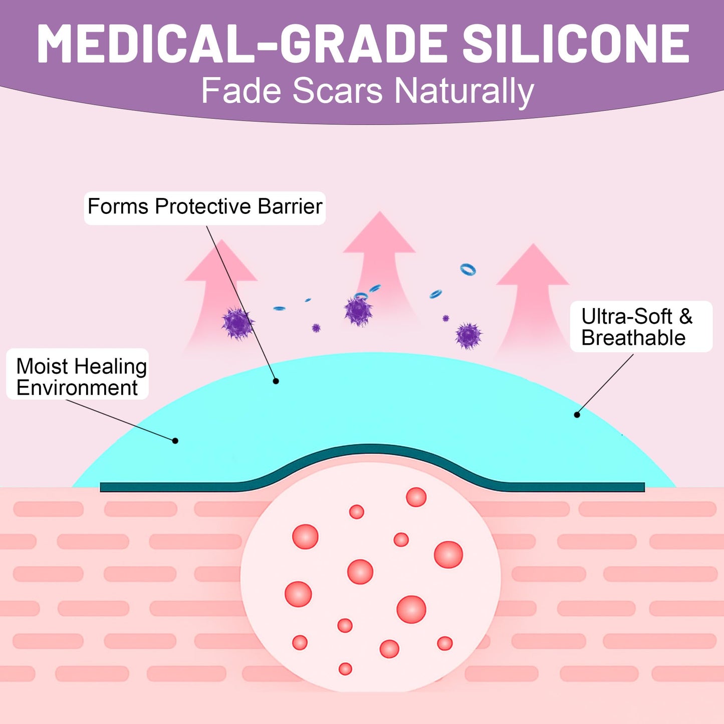 SLGCBL Silicone Scar Tape for Surgical Scars, Silicone Scar Sheets, C Section, Tummy Tuck (1.6”x 60”-1.5M) Reusable Scar Removal Strips for Face, Body, Burns & Keloid Scars