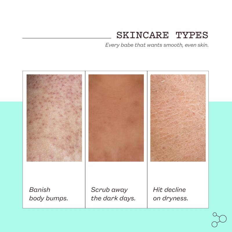 Glycolic Acid Body Scrub - Exfoliating Treatment for KP, Breakouts & Pore Tightening | 8.82 oz