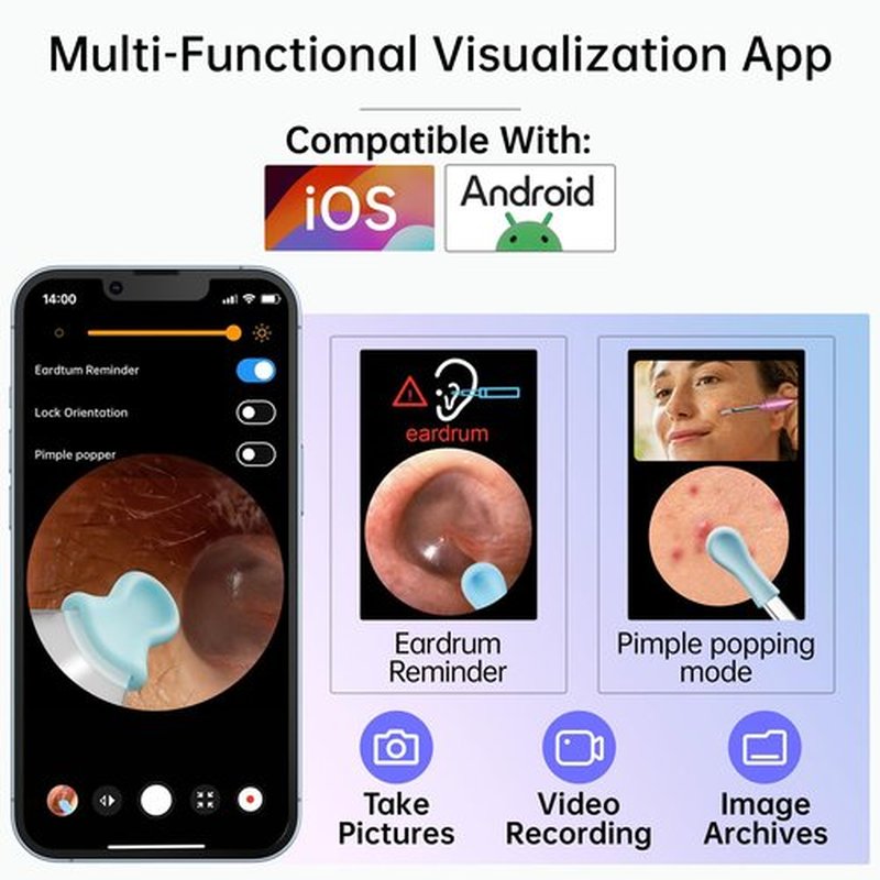 Ear Wax Removal Tool Camera, 1296P HD Camera and 6 LED Lights, Ear Cleaner with Camera, 1296P HD Camera and 6 LED Lights, Ear Cleaning kit, Ear Wax Removal Kit