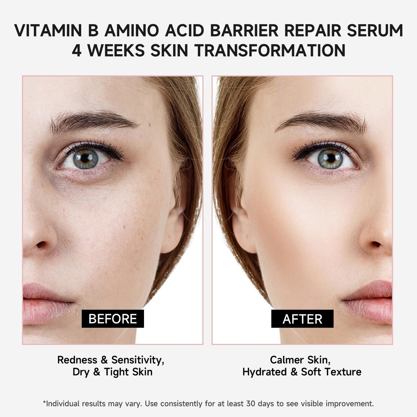 Vitamin B12 Serum for Face - Vitamin B Complex Ampoule with Glutathione, Hyaluronic Acid, Glycine&Arginine, Antioxidant Brightening Hydrating Face Serum for Dry, Sensitive Skin, 1.5ml x 30