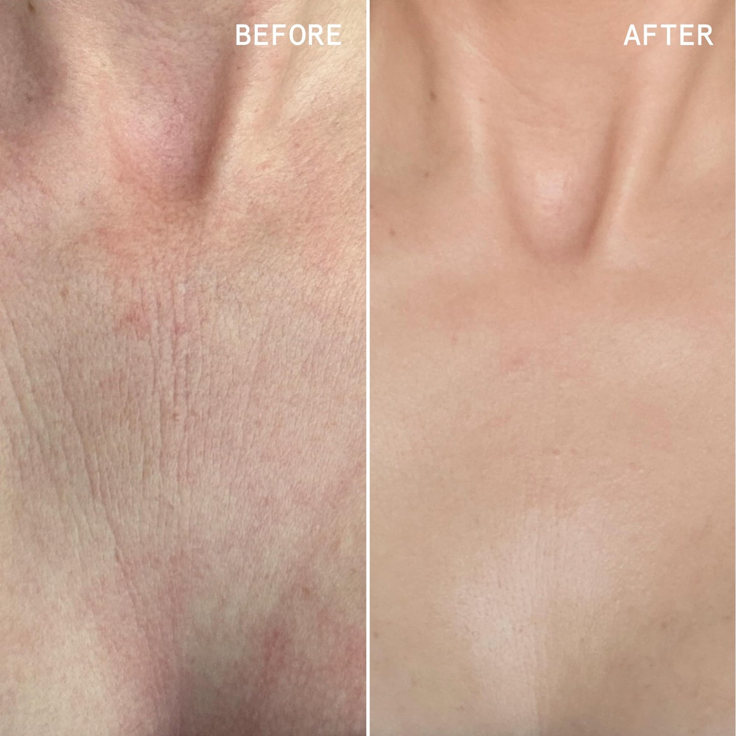 Beauty Pie Über Youth Neck & Chest Tightening Serum Spray | Chest & Neck Firming | Anti Aging Serum | Chest & Neck Tightening And Lifting | Tighten & Lift Skin | Hydrating Elasticity Boost | 3.2fl oz