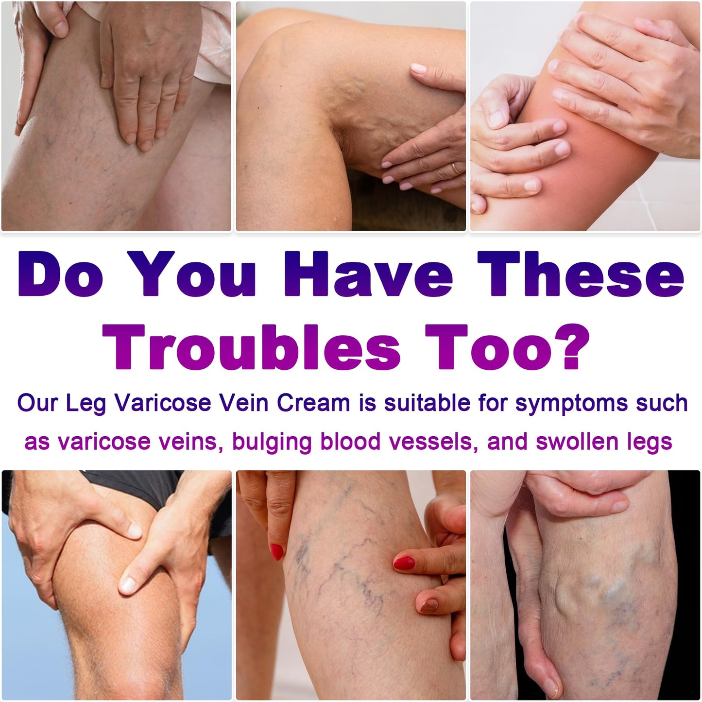 Yongsenina Varicose Veins Cream, Vein Cream & Spider Veins Treatment for Legs, Improves Blood Circulation and Relief From Heavy Fatigued Leg, Refreshing and Non-Sticky, 1Pack