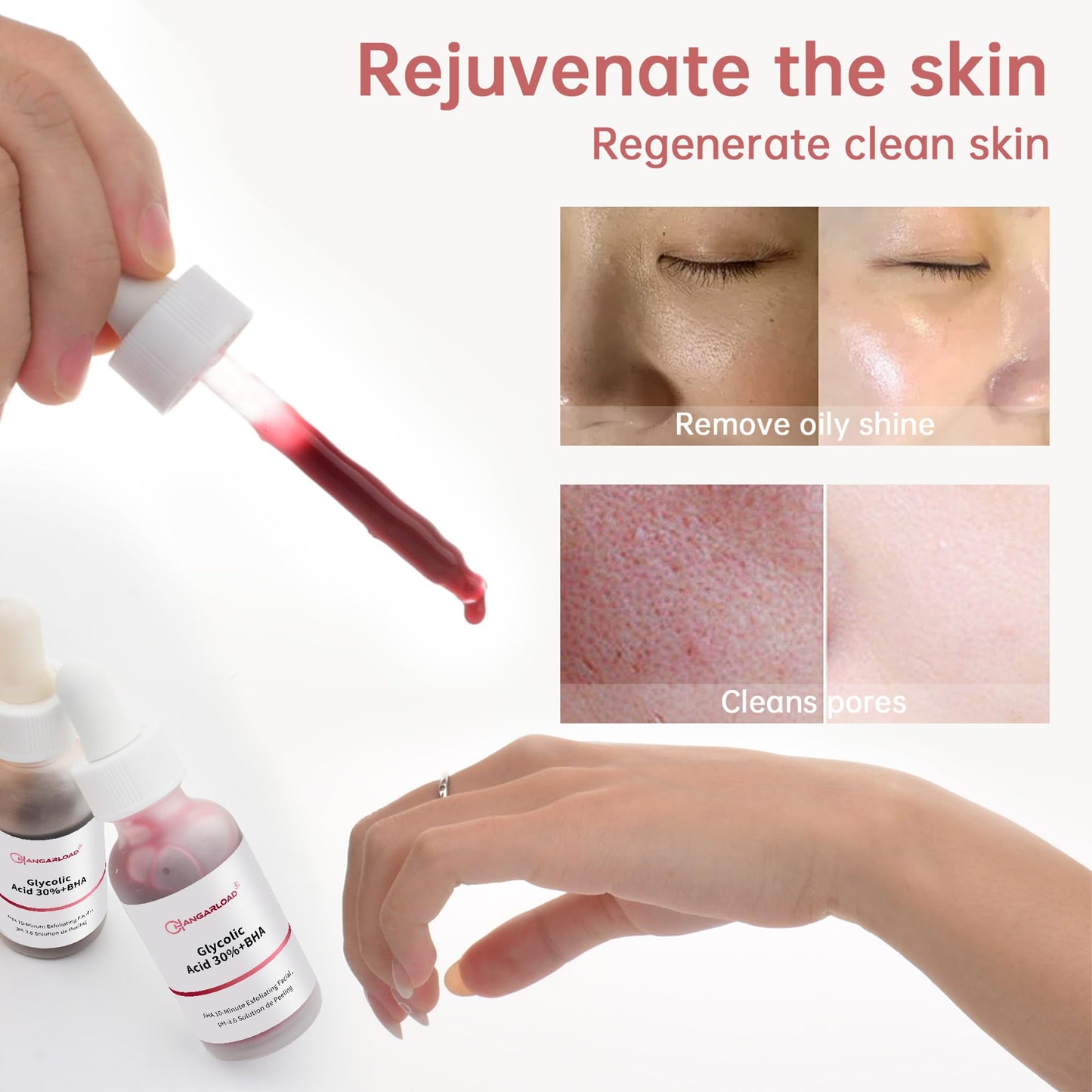 AHA 30% + BHA 2% Peeling Solution 30ml/1oz, Exfoliating Facial Serum, Chemical Peel For Face Serum Glycolic Acid