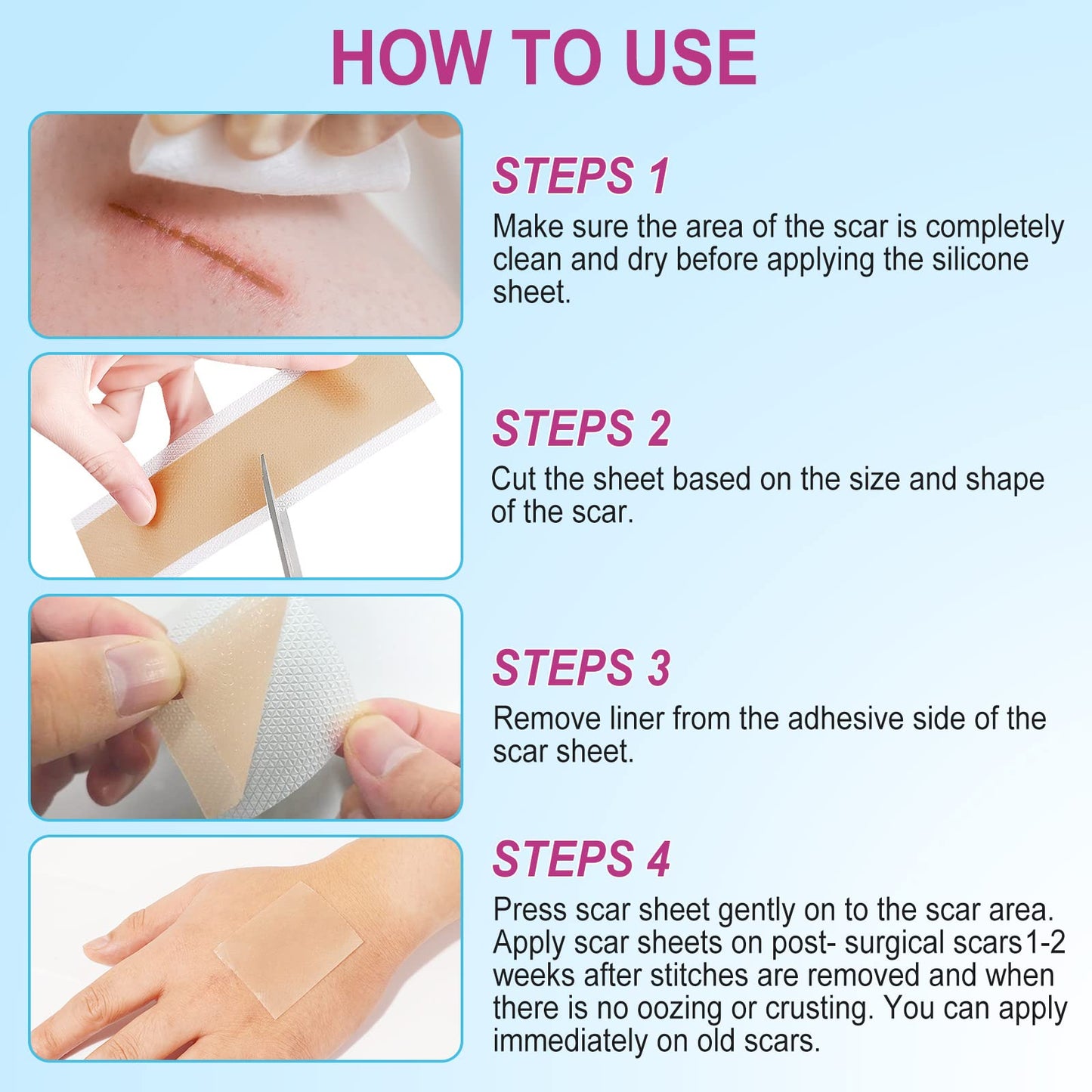 Silicone Scar Sheets (1.6” x 75”-1.9M), Medical Grade Soft Silicone Scar Tape, Scar Strips, Scar Roll - Keloid, C-Section, Surgical, Acne- Scars Removal Treatment, Painless Easy Removal, Reusable