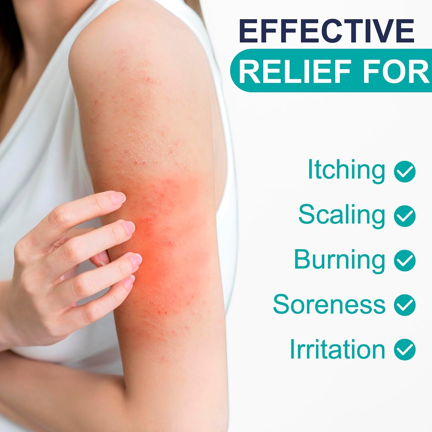 Kerova Antifungal Cream for Athlete’s Foot, Jock Itch & Ringworm – 1% Clotrimazole Antifungal Cream, Ringworm Treatment for Humans, Relieves Burning, Itching, Scaling & Cracking (3.5 Ounce)