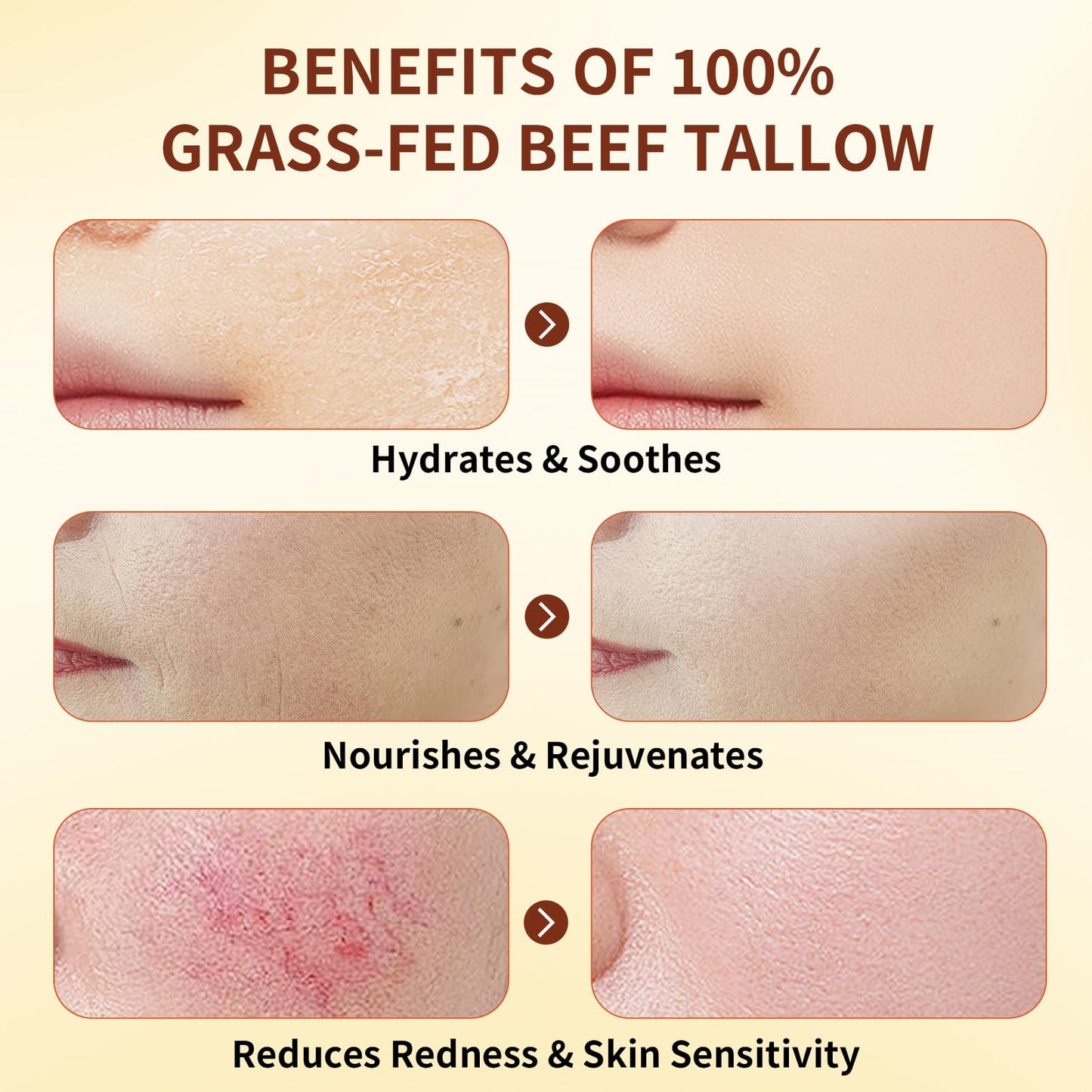 ZDQULX Grass-Fed Beef Tallow Balm with Raw Honey- Facial Moisturizer Cream Beef Tallow for Skin Natural Deeply Moisturizing for Face & Body Sensitive Dry Skin Repair 4.23 Oz
