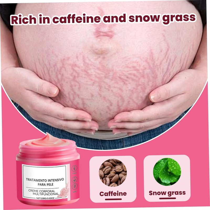 Pregnancy Stretch Mark Cream - Rose Scented Belly Butter for Skin Care | 100g Daily Moisturizer