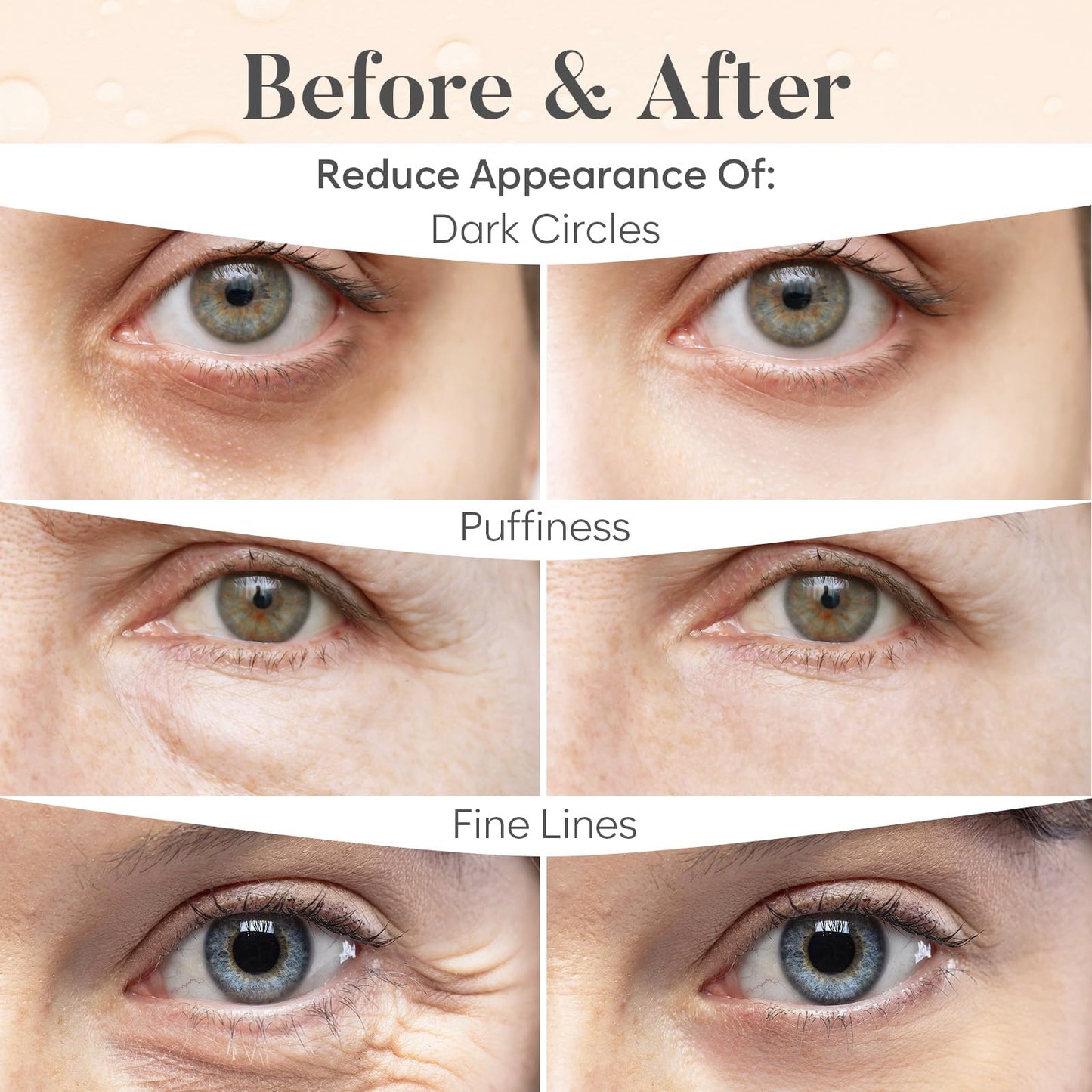 BLOOMORA Caffeine Under Eye Patches (20 Pairs) - Dark Circles & Puffiness Care - Hydrating Caffeine Eye Mask