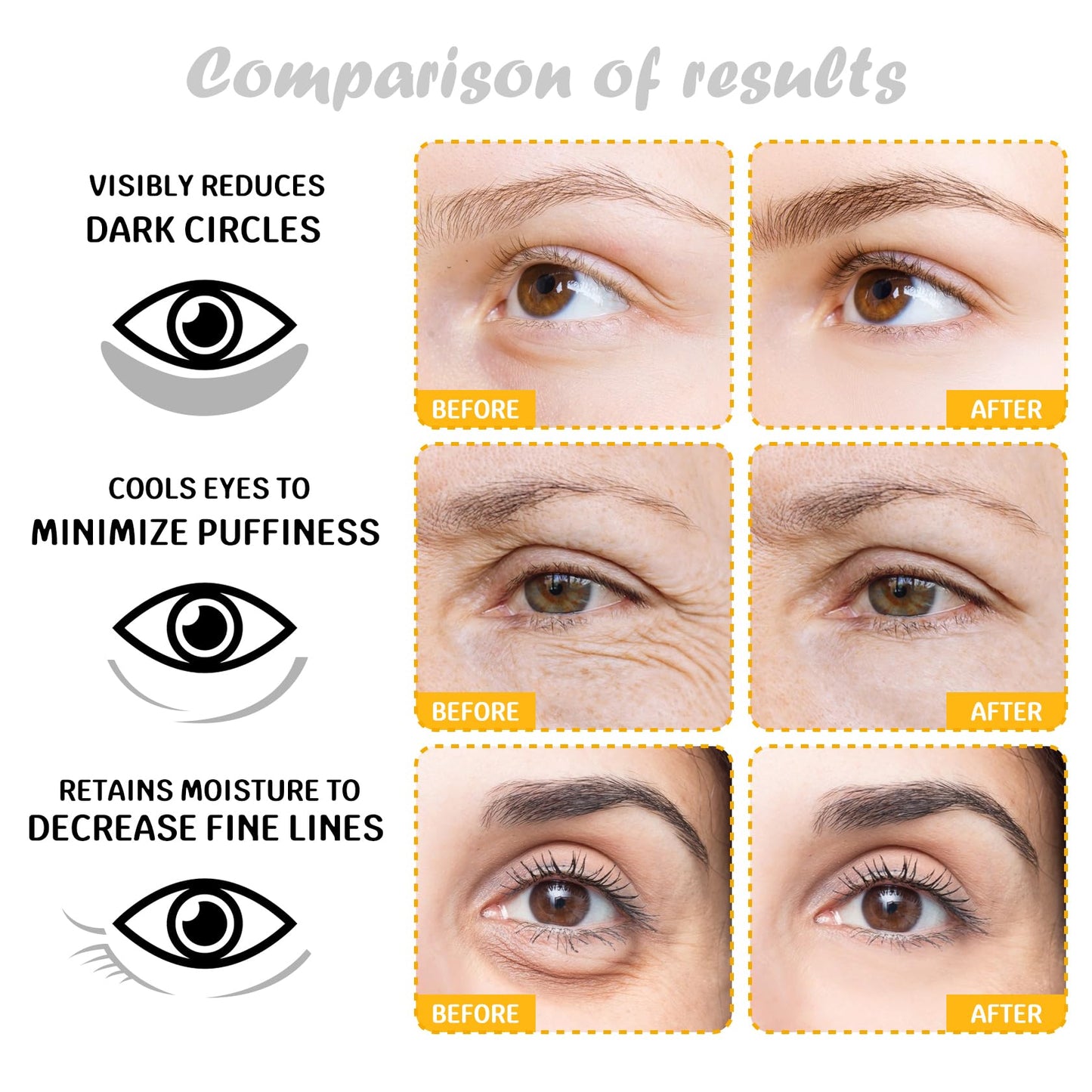 30 Pairs Under Eye Patches for Dark Circles,Moisturizing Under Eye Masks Skincare,Highly Hydrating Eyepatches for Women and Men,Refreshing Eyemasks Travel Eye Pads