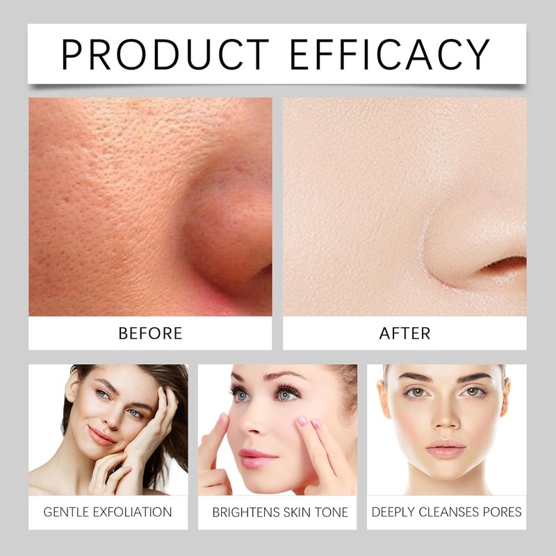 Rice Peeling Ampoule Set - Deep Hydration & Gentle Pore Cleansing | 2 Pcs for All Skin Types