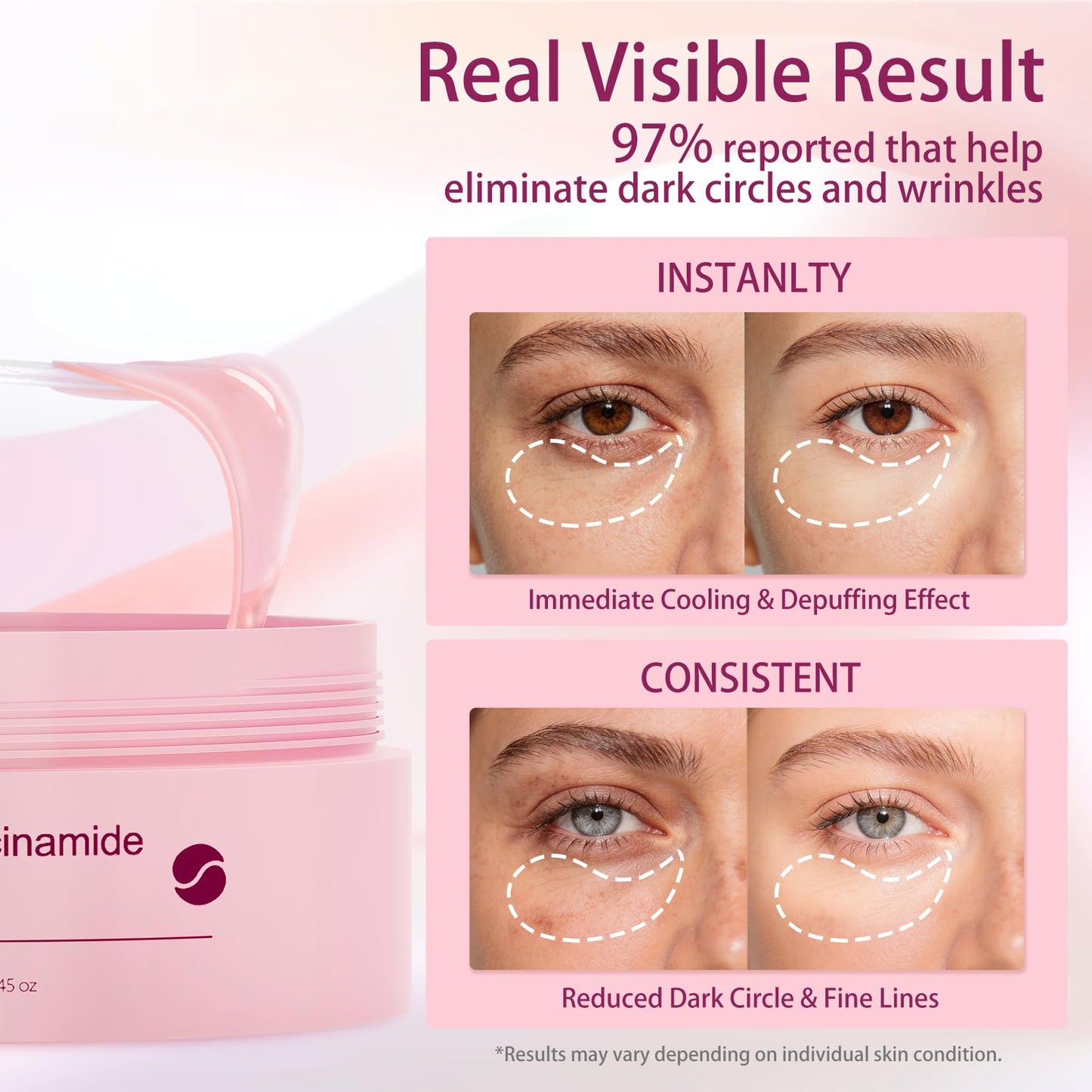 AveCera Under Eye Patches, Eye Masks for Dark Circles, Puffiness, Fine Lines - Caffeine, Niacinamide, Hyaluronic Acid Formula - Brightening, Anti-Wrinkle, Cooling & Hydrating, Under Eye Treatment