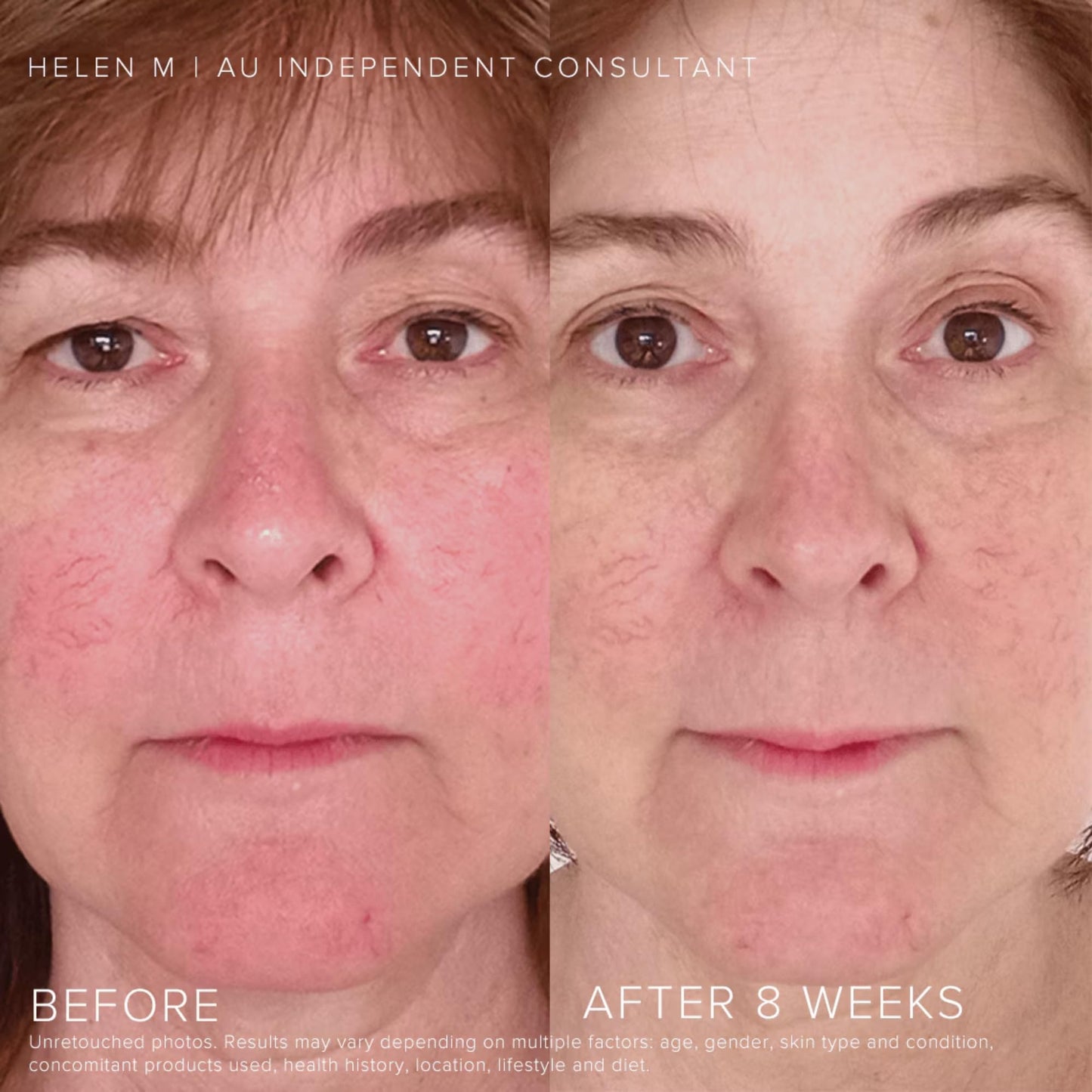 Rodan + Fields Soothe Daily Mineral Sunscreen SPF 30 | 1 Fl Oz | SPF Moisturizer for Face | Zinc Oxide Sunblock | Travel Size Sun Protection Skincare