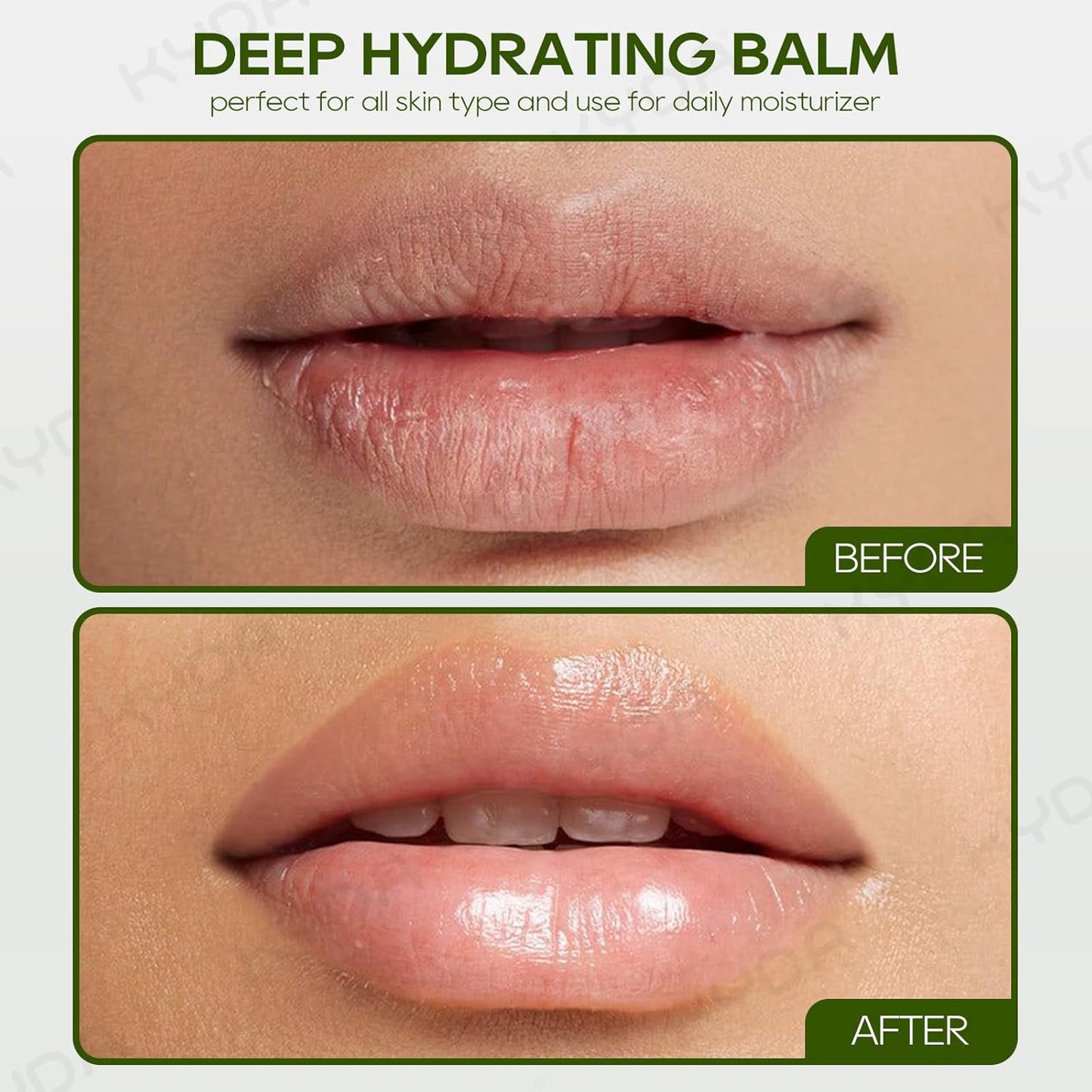 Aloe Vera Lip Balm Set - Deep Hydrating Formula for Dry, Cracked Lips | 3 Pcs, Colorless Finish