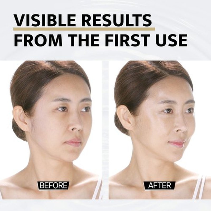 DOCTORCOS Super Lifting Skin Mask Set | Silicone Mask (Reusable) + Aqua Glow Mask (3.71 oz) + Fill up Wrinkle Cream (1.69 oz) | Full face Lifting Package | Neck and eye lift | Korean Skin Care