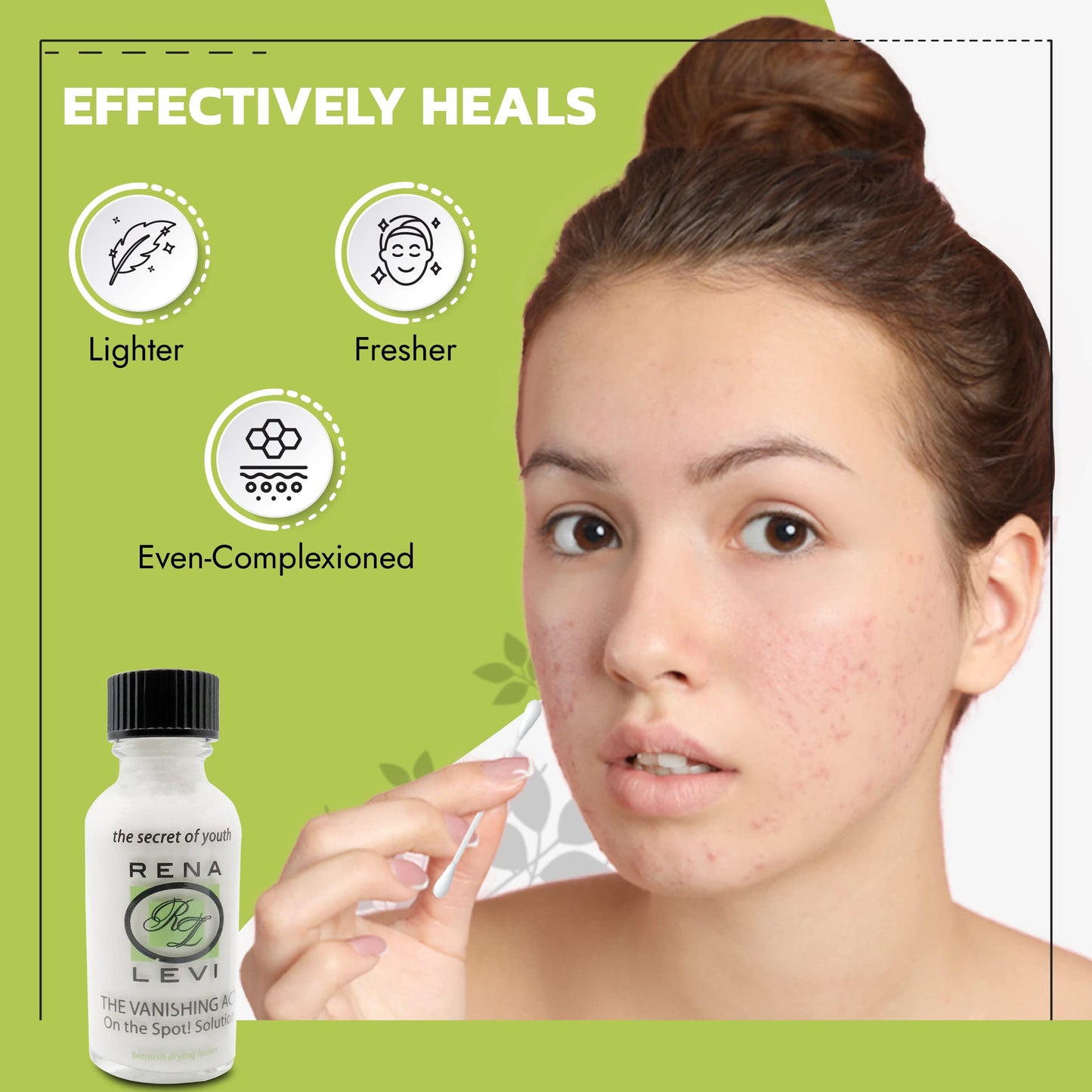 Rena Levi Acne Spot Pimple Drying Lotion - For Face and Body Use, Dries Out Blemishes and Pores - 1oz