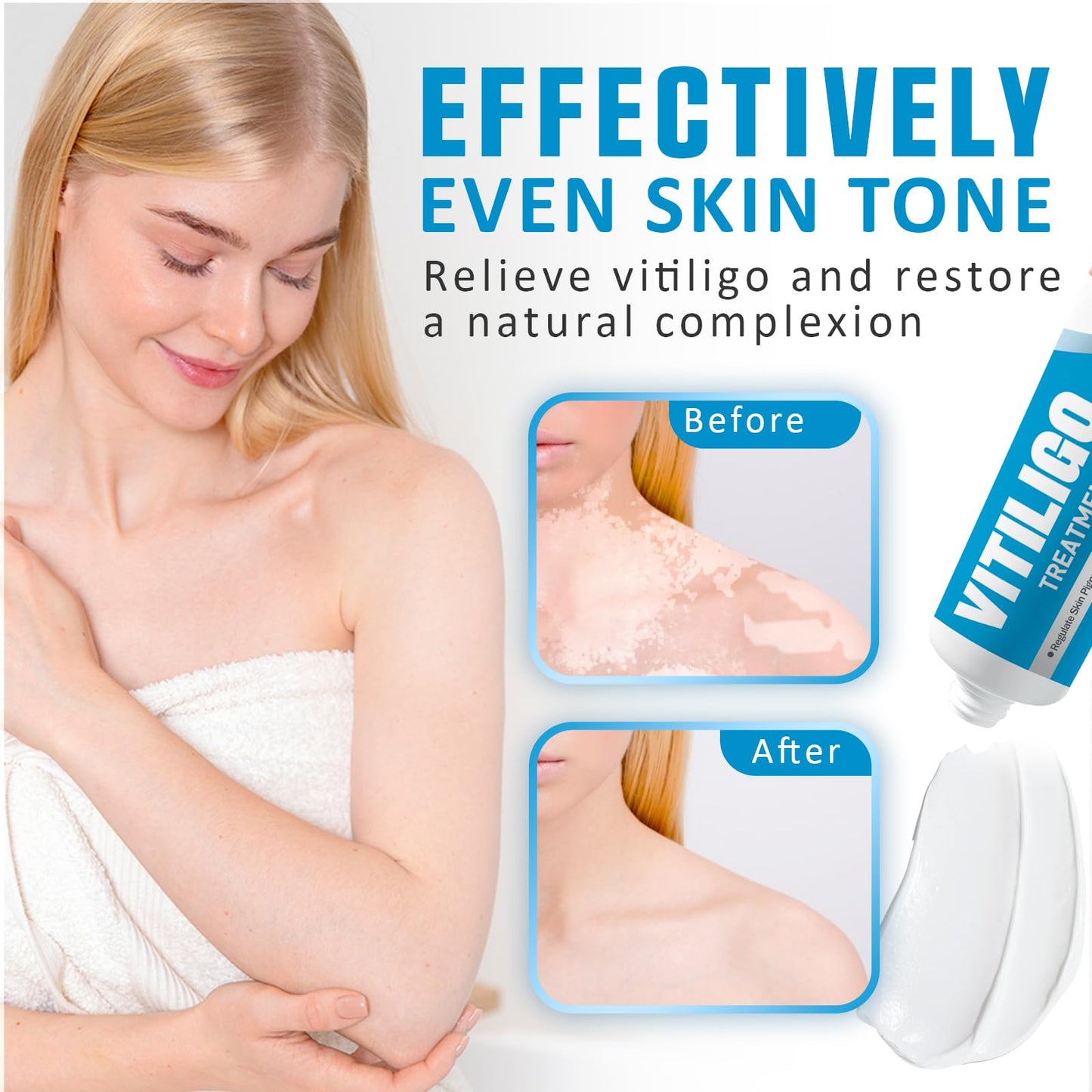 VEXWOLQ Vitiligo Cream, Natural Vitiligo Treatment Cream for Skin Vitiligo-Improve Pigmentation & Fade White Spots, Skin Topical Cream with Gentle Formula for women & men, 20g
