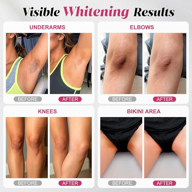Brightening Skin Lightening Soap - Niacinamide & Arbutin Formula for Hyperpigmentation | Ideal for Underarms, Knees, Elbows & Bikini Area