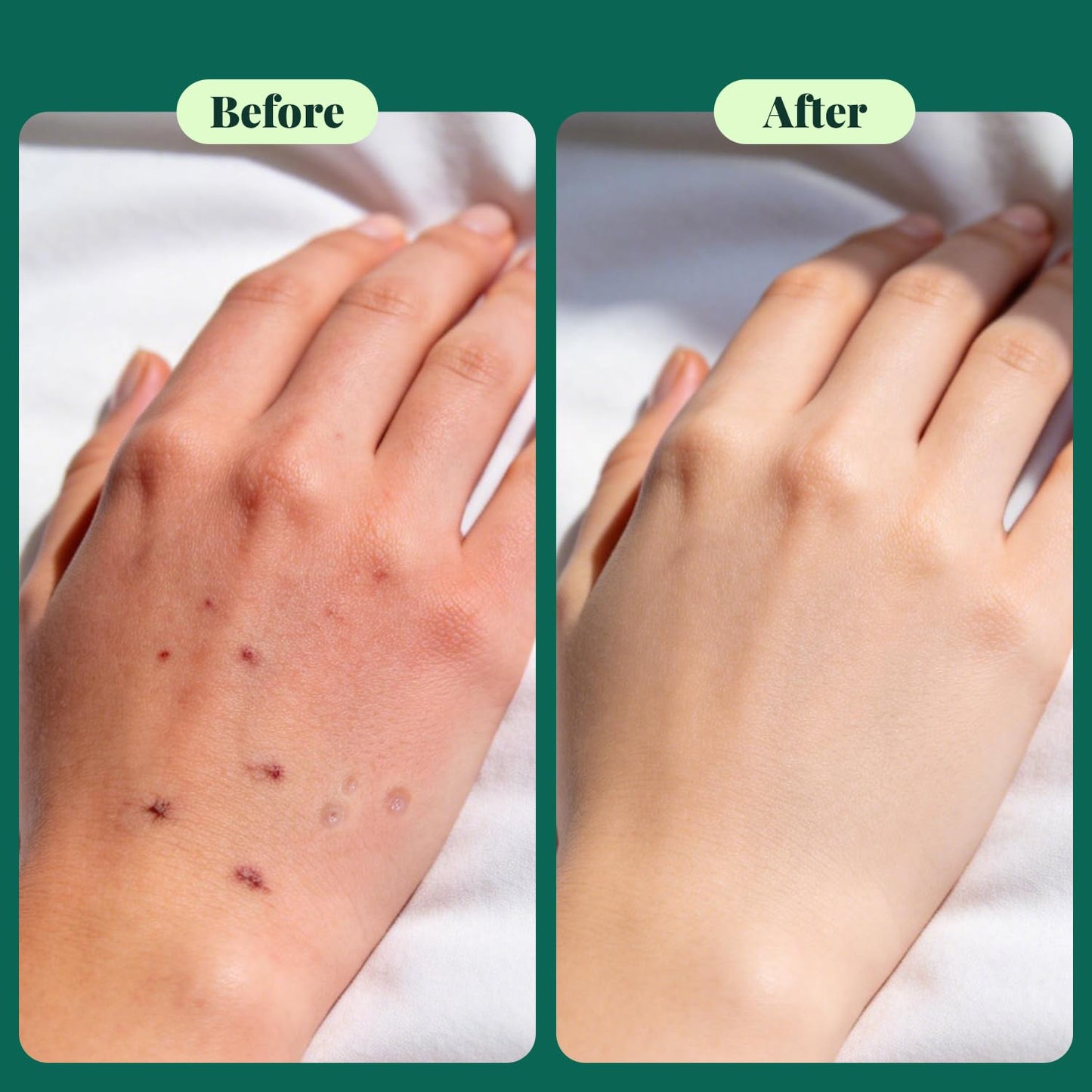 ULARCS Permenathrinol Moisturizing Cream, 5%, Non-Irritatting Cream, 1oz