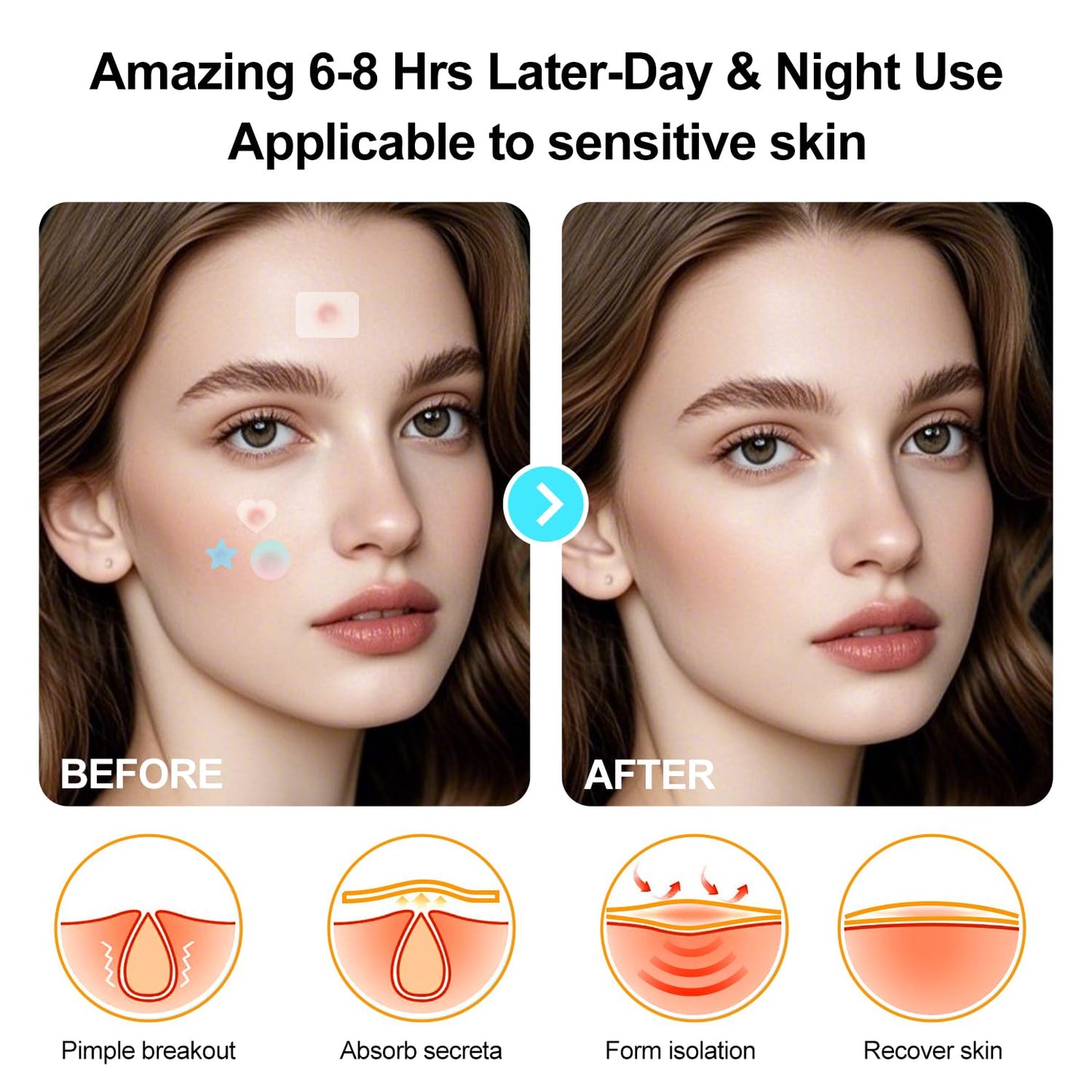 Pimple Patches for Face, Various styles, colors, Large Hydrocolloid Pimple Patches, 300 Count Pimple Patche, Good for blemishes with a head and visible gunk, With a Cute mirror case