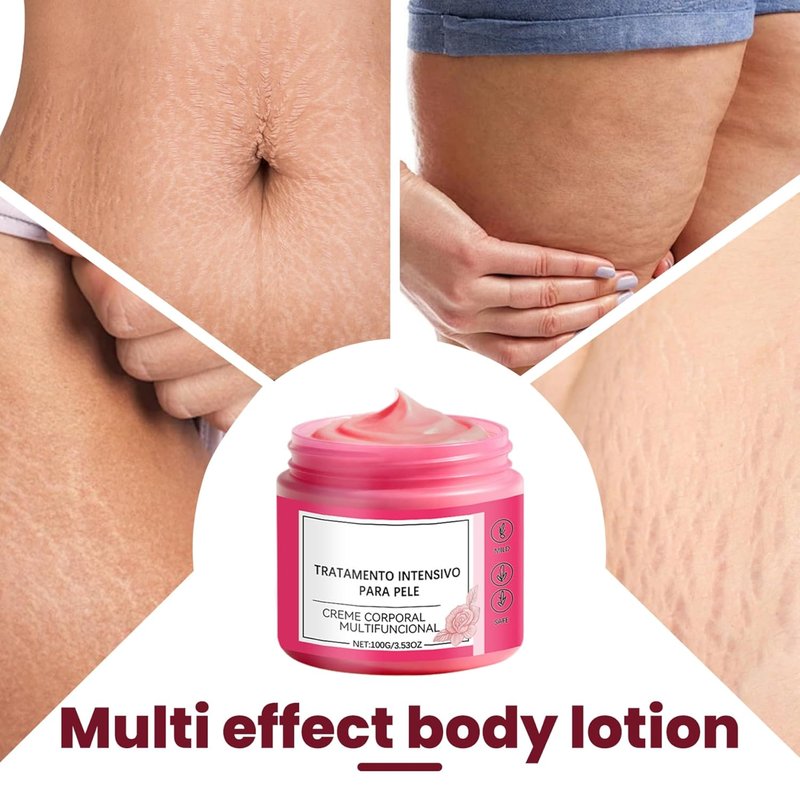 Pregnancy Stretch Mark Cream - Rose Scented Belly Butter for Skin Care | 100g Daily Moisturizer