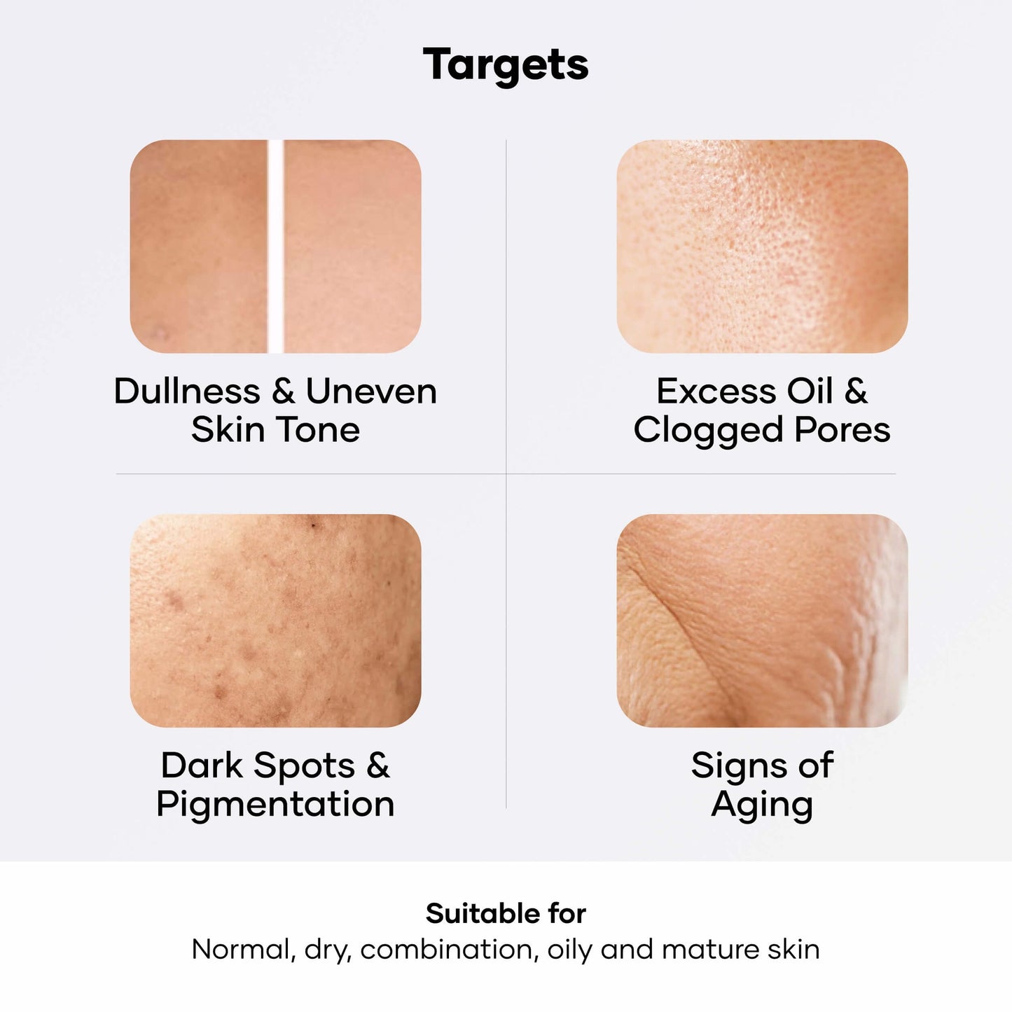 Cureskin Vitamin Boost Face Mask | D Tan Pack for Tan Removal, 1.76 Ounce (Pack of 1)