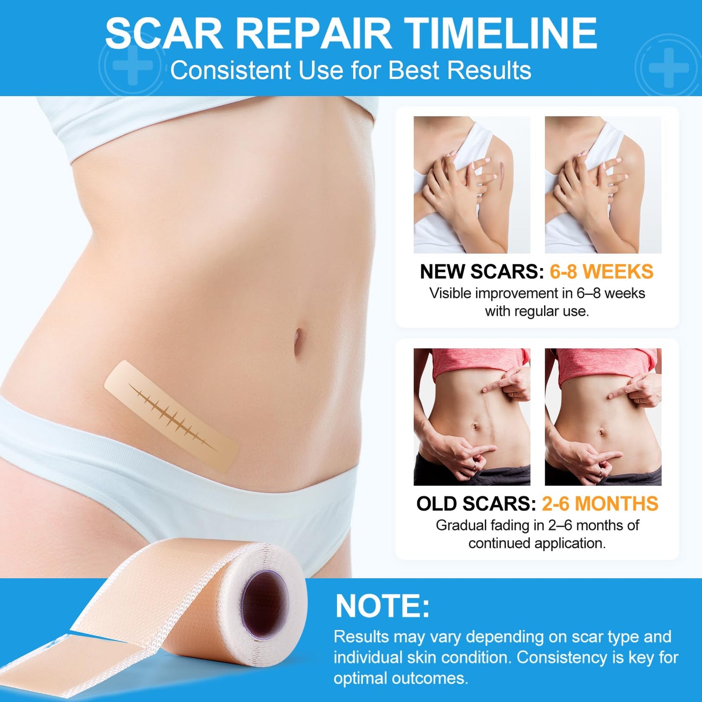 Silicone Scar Sheets, (1.6"X120" Roll-3M) Silicone Scar Tape, Scar Tape for Surgical Scars, Medical Grade Scar Tape with Collagen,For Surgical,C-Section,Tummy Tuck,Keloid Scars, Keloid Bump Removal