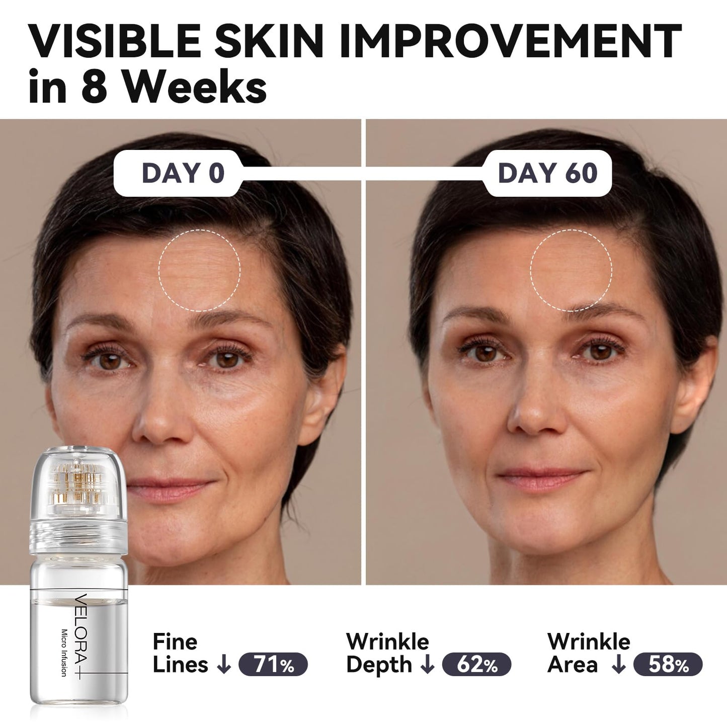 Styirl Micro Infusion System for Face – Hydrating Serum with Hyaluronic Acid & Peptides, Firmer Radiant Skin, Face Serum and Stamp 0.25mm (3-Month Supply)