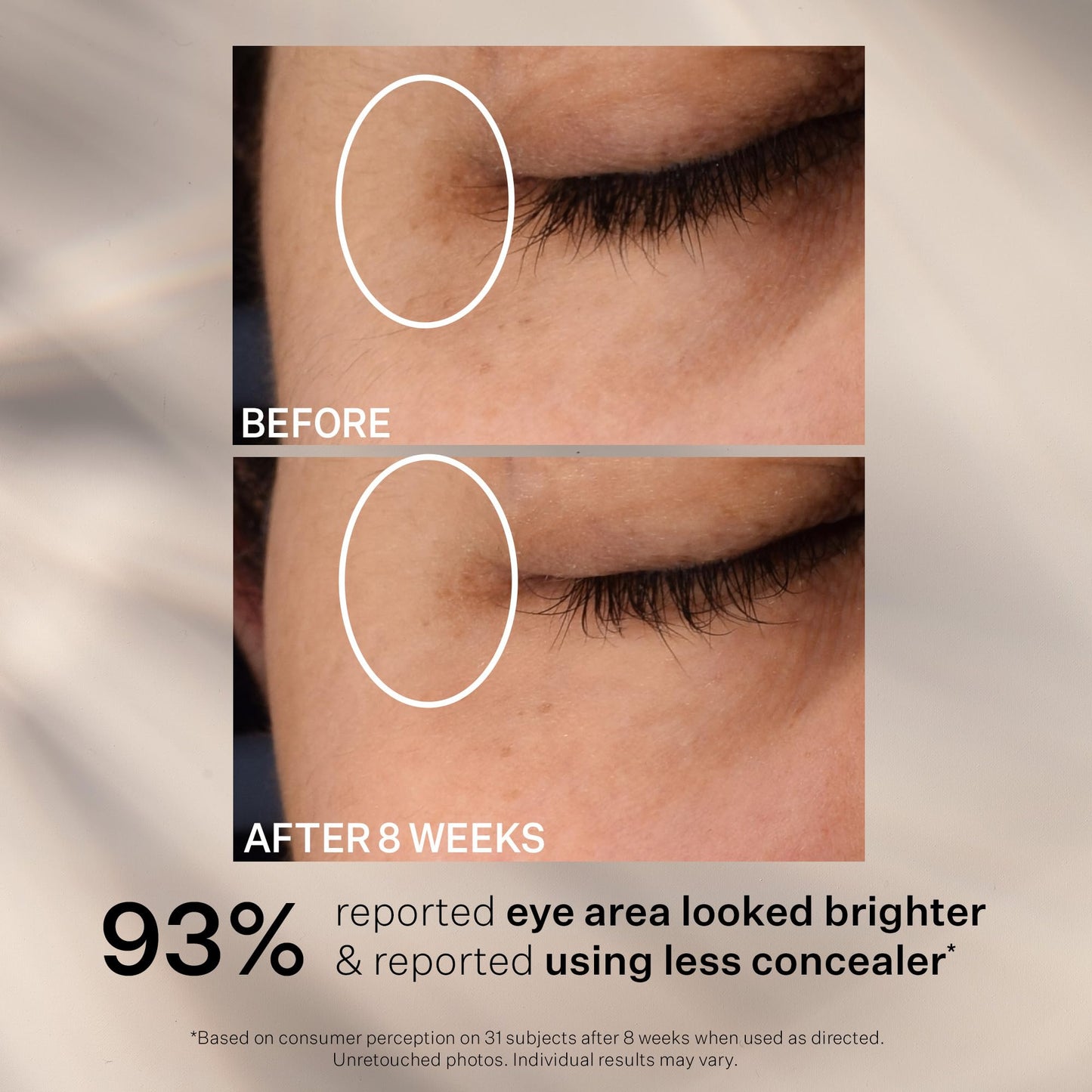 StriVectin Super C Dark Circle Brightening Eye Serum, 0.5 oz