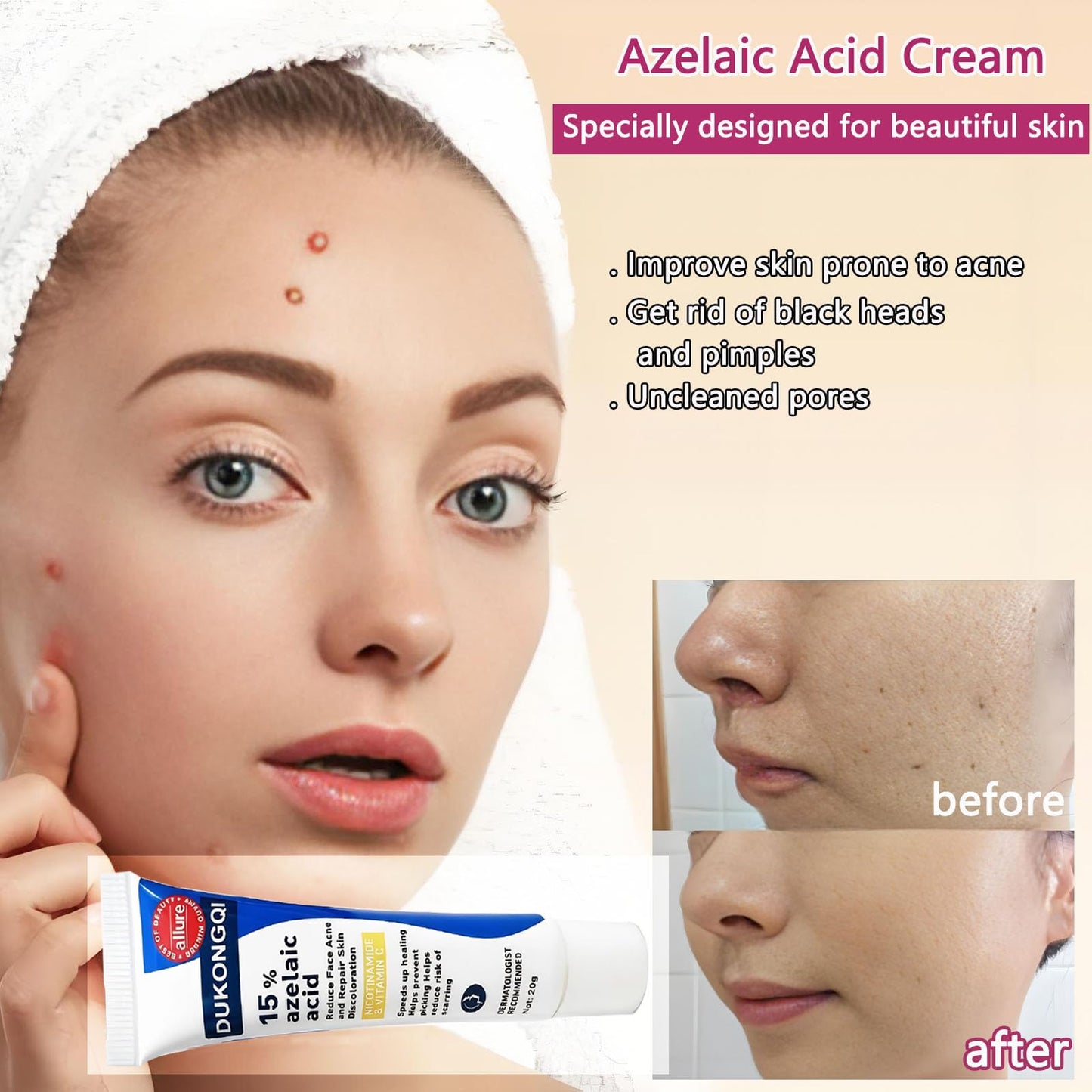 Azelaic Acid for Face Balance Skin Tone & Cleanse Pores, Azelaic Acid Serum Acido Azelaico-Relieve Acne, Blackhead & Redness,Premium Skin Care, 20g (1 PCS)