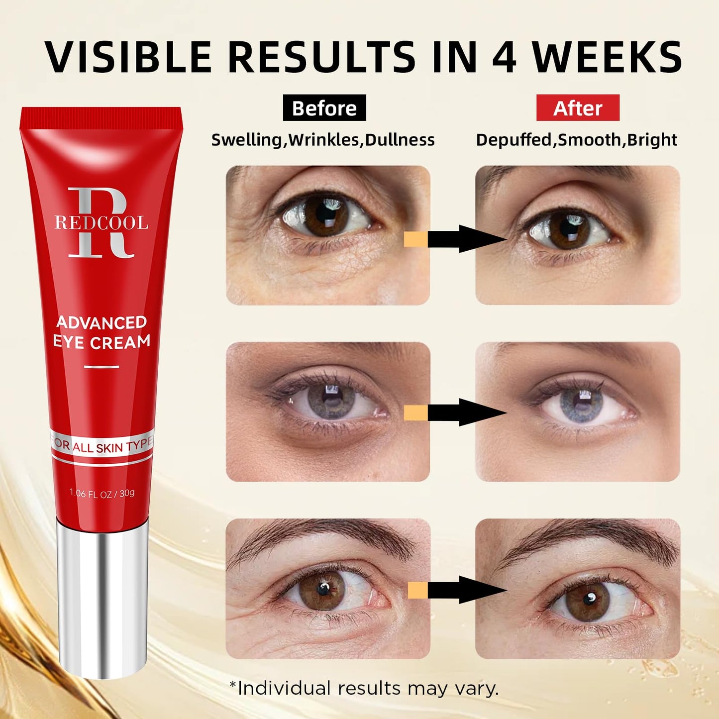 Redcool Retinol Eye Cream for Dark Circles, Anti-Aging Eye Cream with Hyaluronic Acid & Caffeine, Reduces Wrinkles, Puffiness & Fine Lines, Day and Night Use, 1.06 fl oz