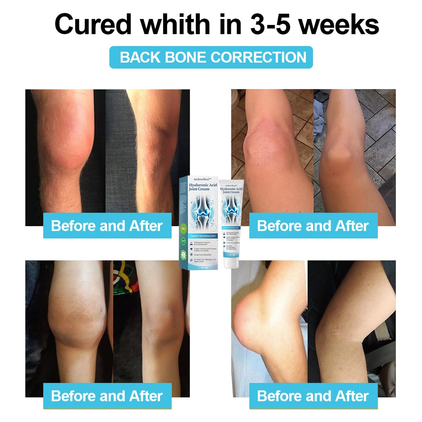 ArthroHeal Hyaluronic Acid Joint Repair Cream,Hyaluronic Acid Joint and Bone Cream for Arthritis, ArthroHeal Arthritis Cream, Effective Relief for Back, Neck, Hands, Kneel (1 Pack)