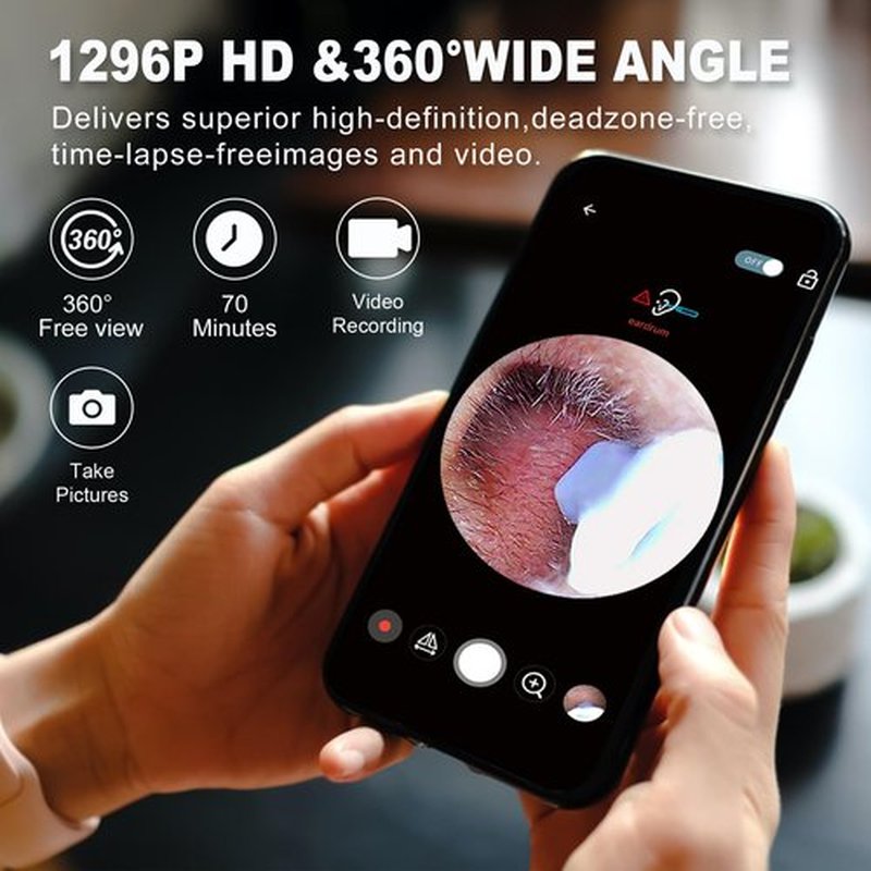 Ear Wax Removal, Ear Cleaner with Camera and Light, Ear Wax Removal Kit with 1296P Otoscope, Ear Cleaning Tool with 6 Ear Spoon, Ear Camera for iPhone & Android Phones,White