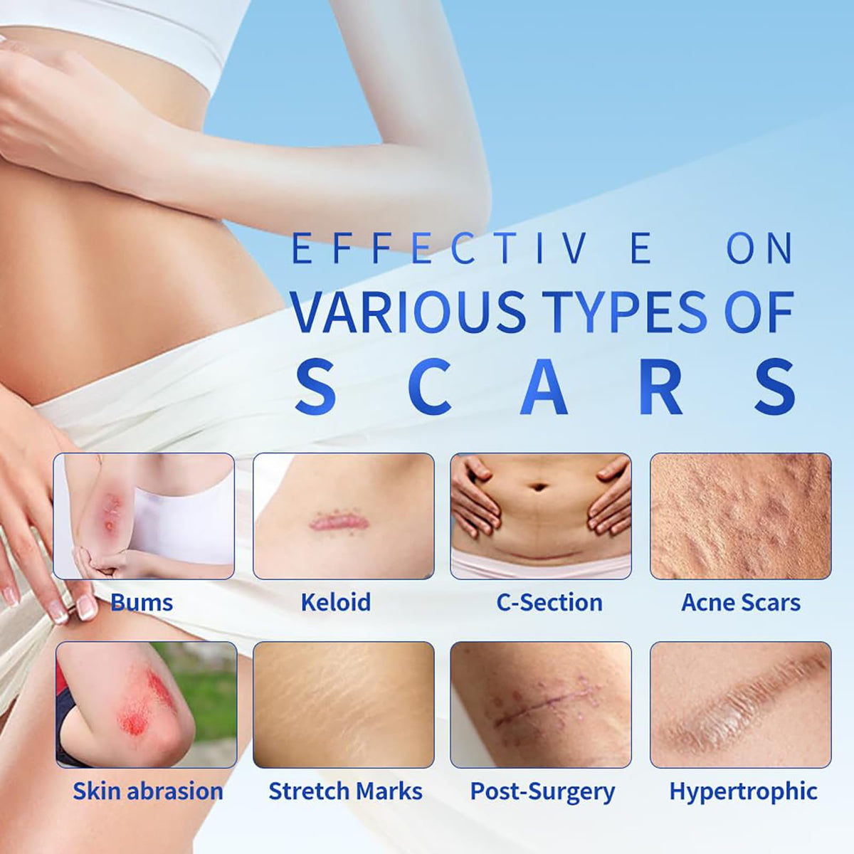 Silicone Scar Sheets 1.6"x39.4" Roll-1M Scars Removal Treatment Medical Grade Silicone Scar Tape for Skin Resuable Strip for Tummy Tuck,Incision,Keloid,C-Section,Burn,Acne Scars(pink)