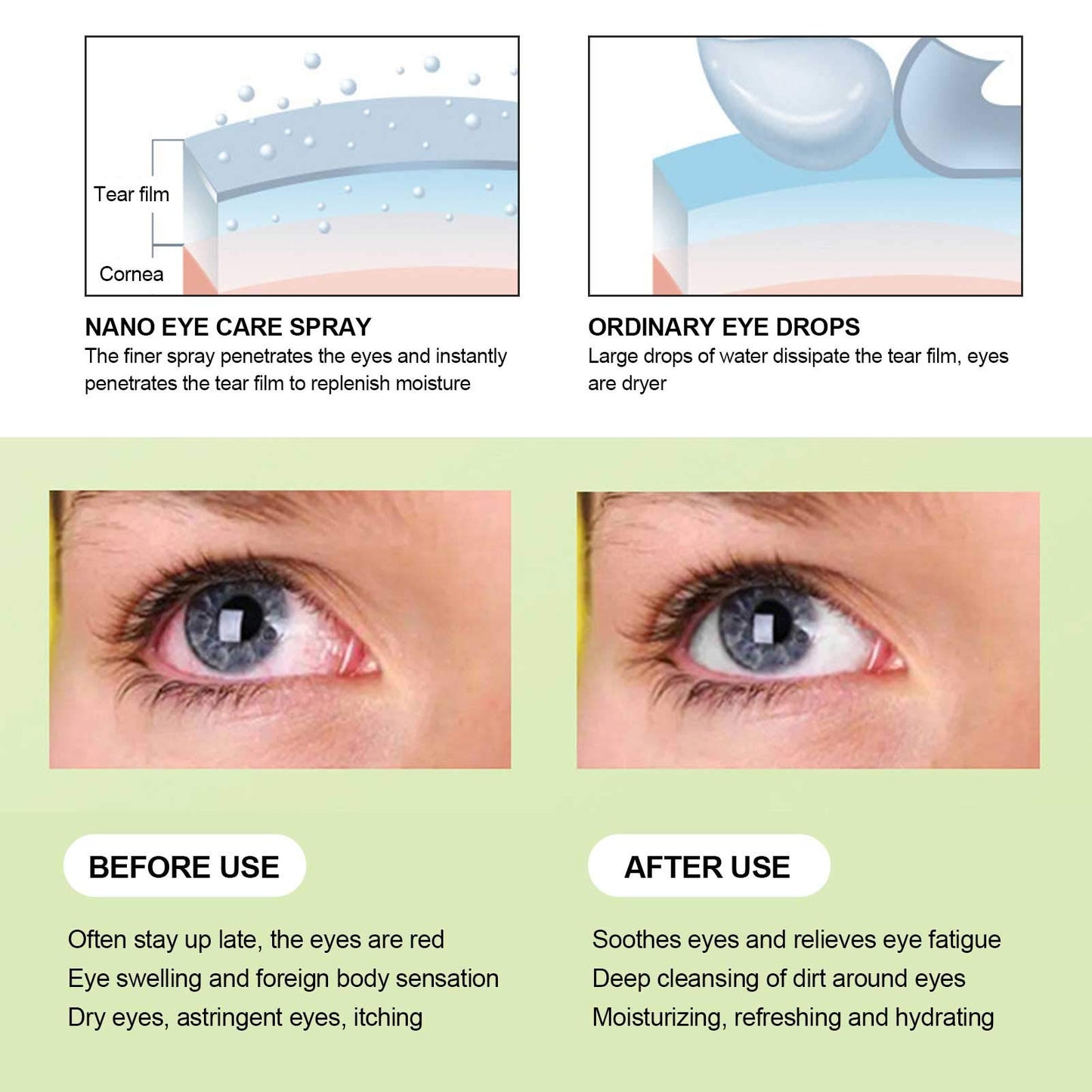 Brrnoo Eye Spray USB Charging Handheld Eye Care Spray, Mist for Tired and Dry, Portable Moisturizing Soothing Machine New moisturizing instrument cyan blue