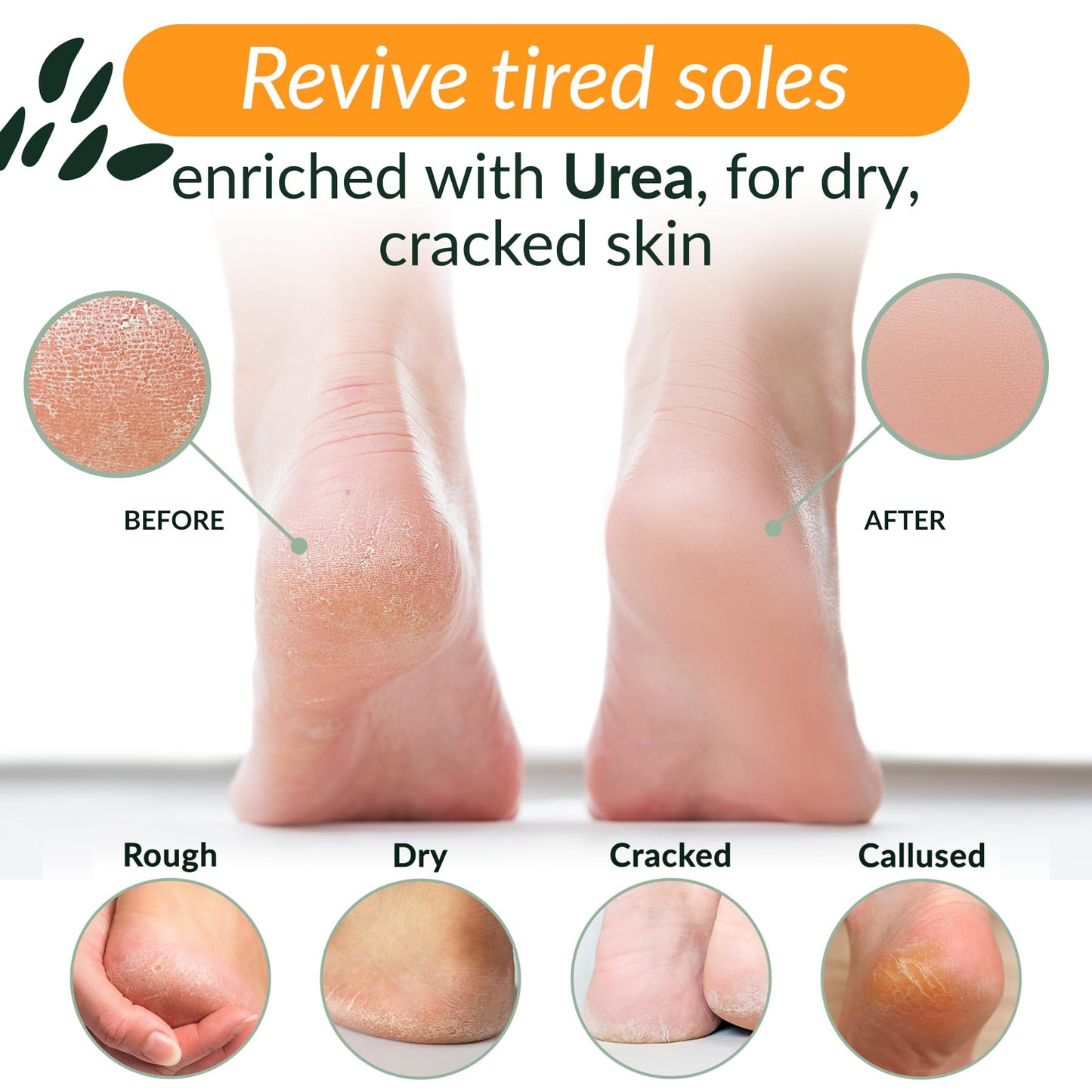 Tree To Tub Foot Cream for Dry Cracked Heels and Feet - Foot Lotion for Dry Cracked Feet, Non-Greasy Moisturizer Urea Cream w/Softening Shea Cocoa Butter, Citrus Foot Care for Women & Men