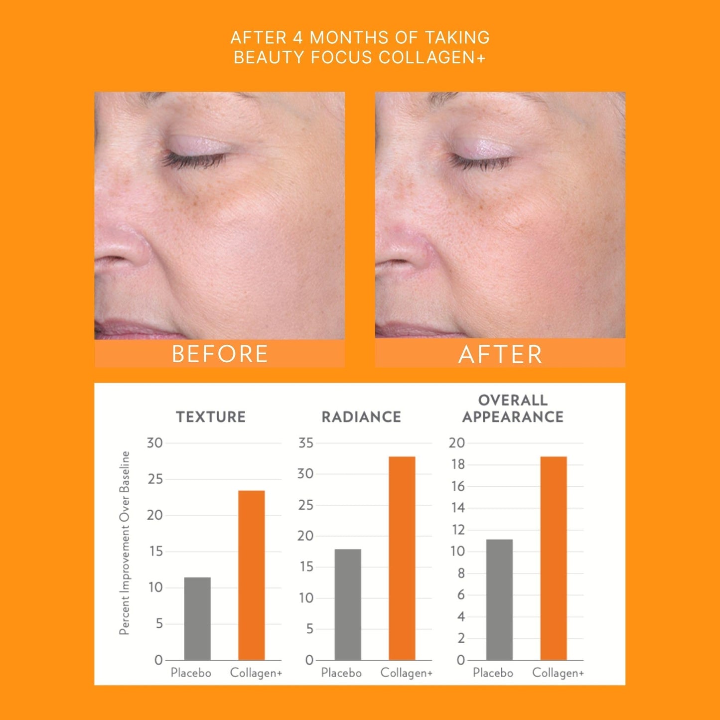 Nu Skin Beauty Focus Collagen + | 30 Pouches | Strawberry Flavored