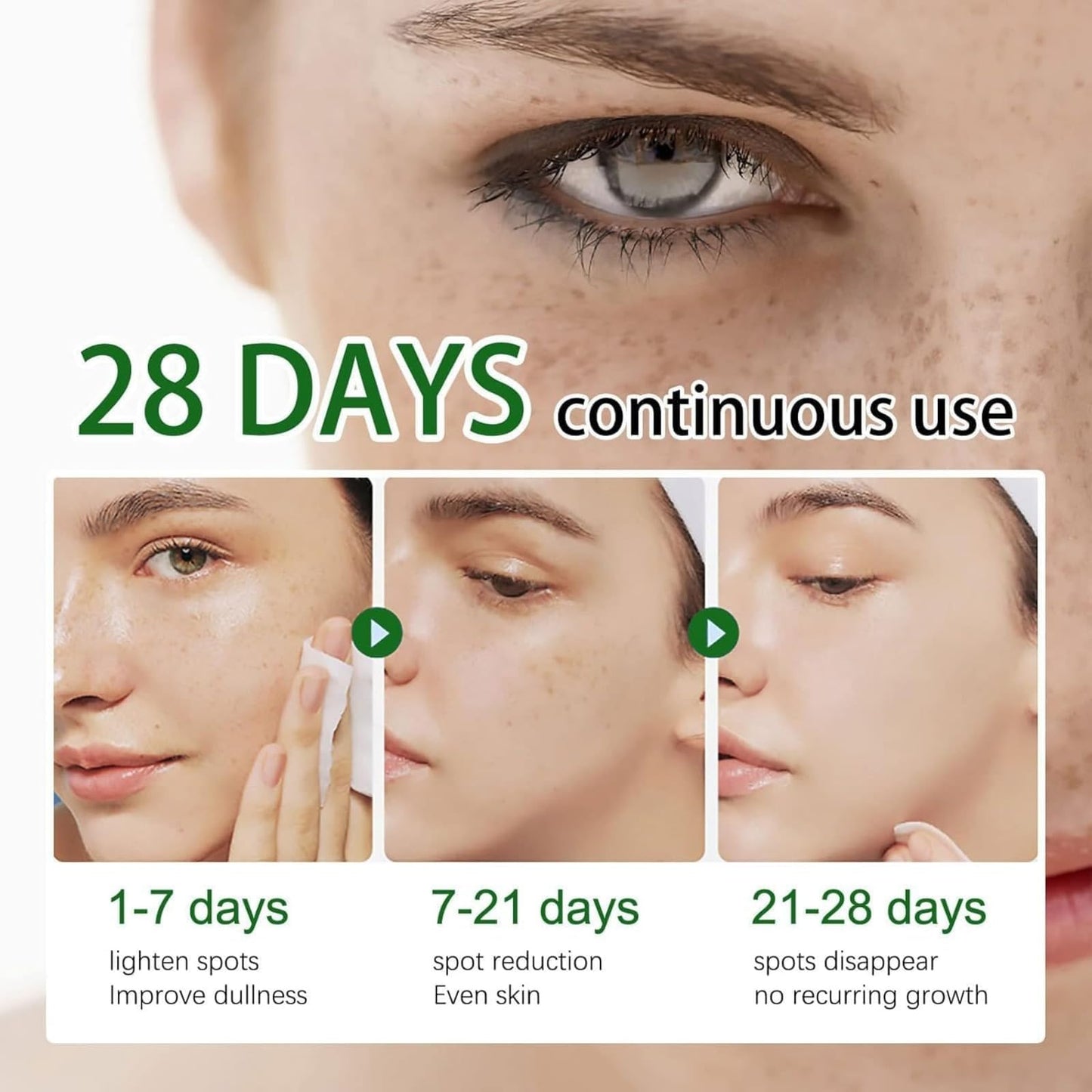 Crema para Manchas Oscuras en La Cara, Cremas para Quitar Manchas de La Cara, Crema para Arrugas, 20 ML / 0.7 FL Oz (3 PCS)
