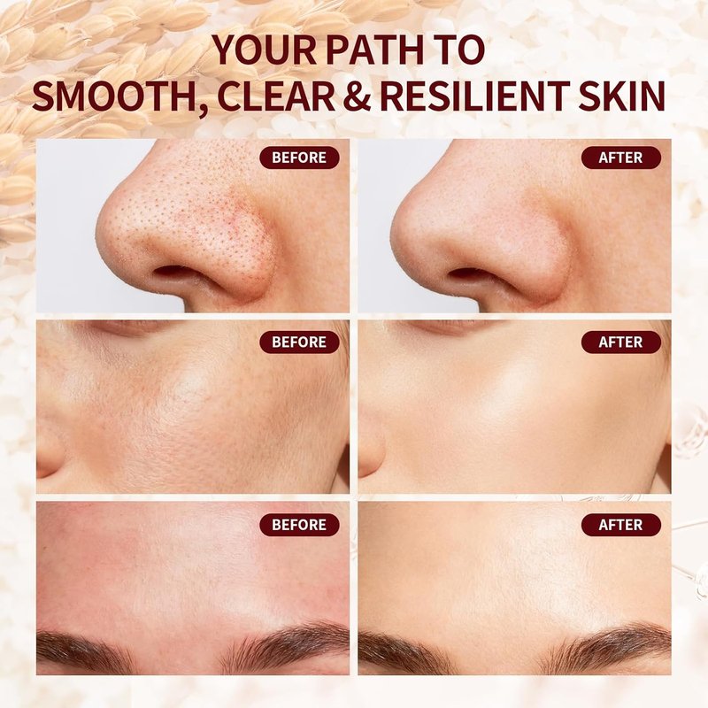 Glow Rice Exfoliant Ampoule - 5% Complex Acid Exfoliating Serum with Salicylic Acid | Brightening for Sensitive Skin