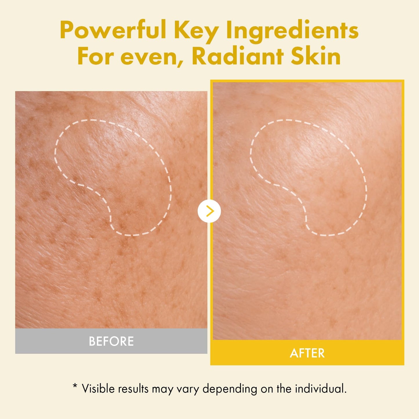 TOSOWOONG Real Kojic Acid Turmeric Fit, Dark Spot Wrapping Mask, Vitamin C & Glutathione Peel Off Facial Mask for Even Tone, Elasticity, Hydrating, Glow, Glass Skin, Korean Skincare, 50ml/1.69 fl. oz.