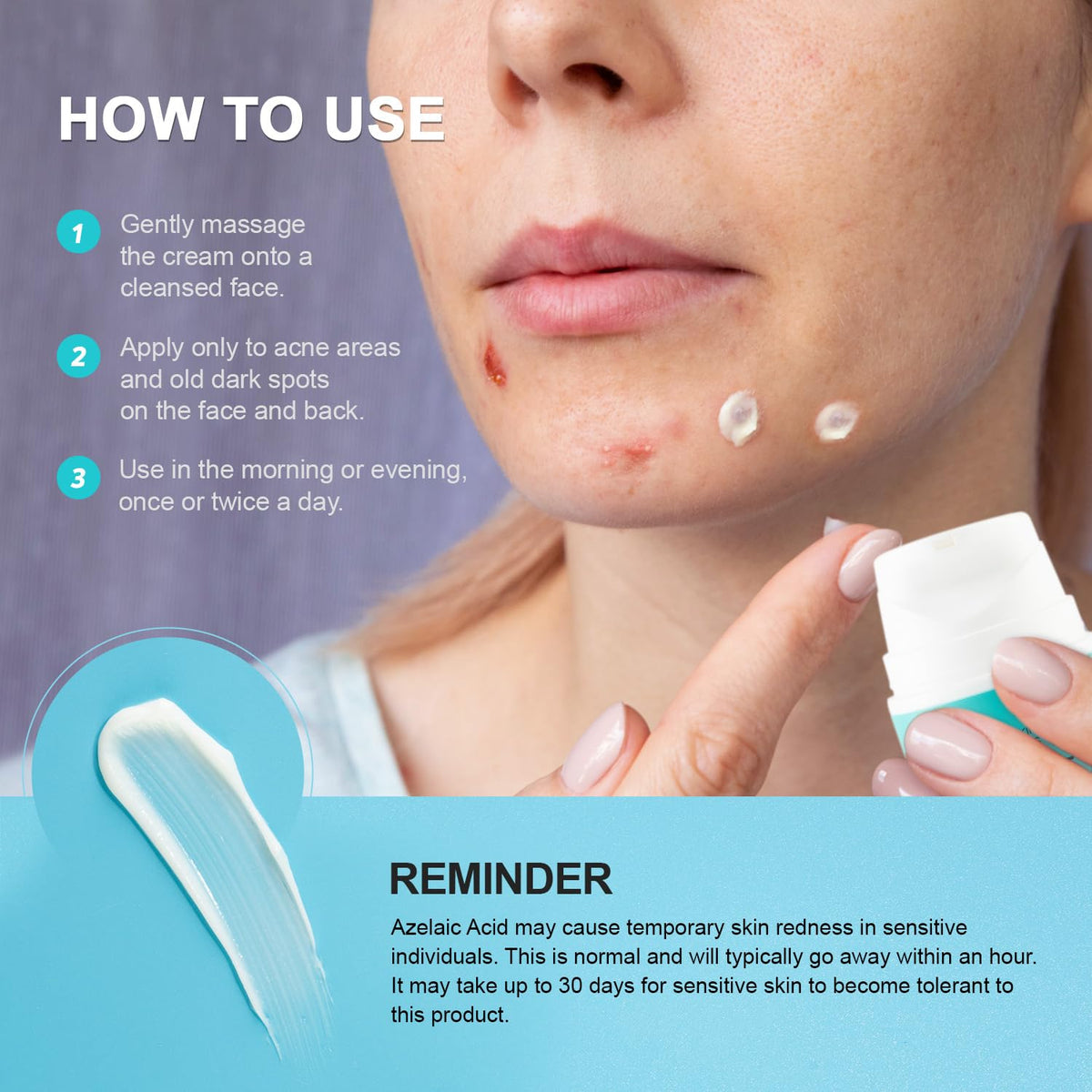 Acne Pimple Spot Treatment Cream: Cystic Hormonal Breakouts Control for Face & Back - 2% Salicylic Acid, Fast Redness Relief, Fades Blemishes & Post-Acne Marks, Teens-Adults, 1.8 oz