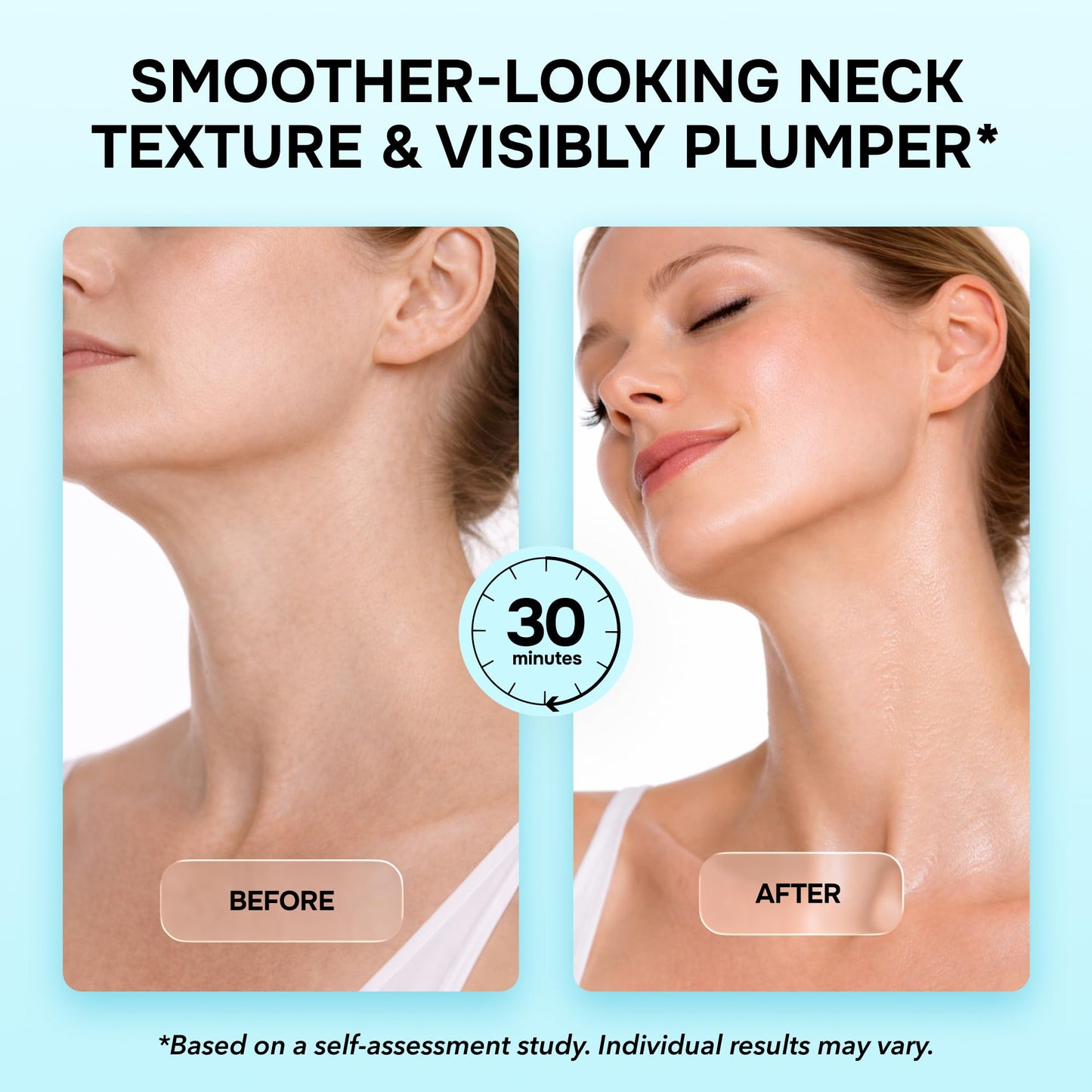 V Line Lifting Mask with Collagen, Retinol & Hyaluronic Acid - Caffeine, Niacinamide Visible Neck Tightening and Chin Lifting Mask for Women - Double Chin Strap for Face & Jawline Shaper - 5 pcs