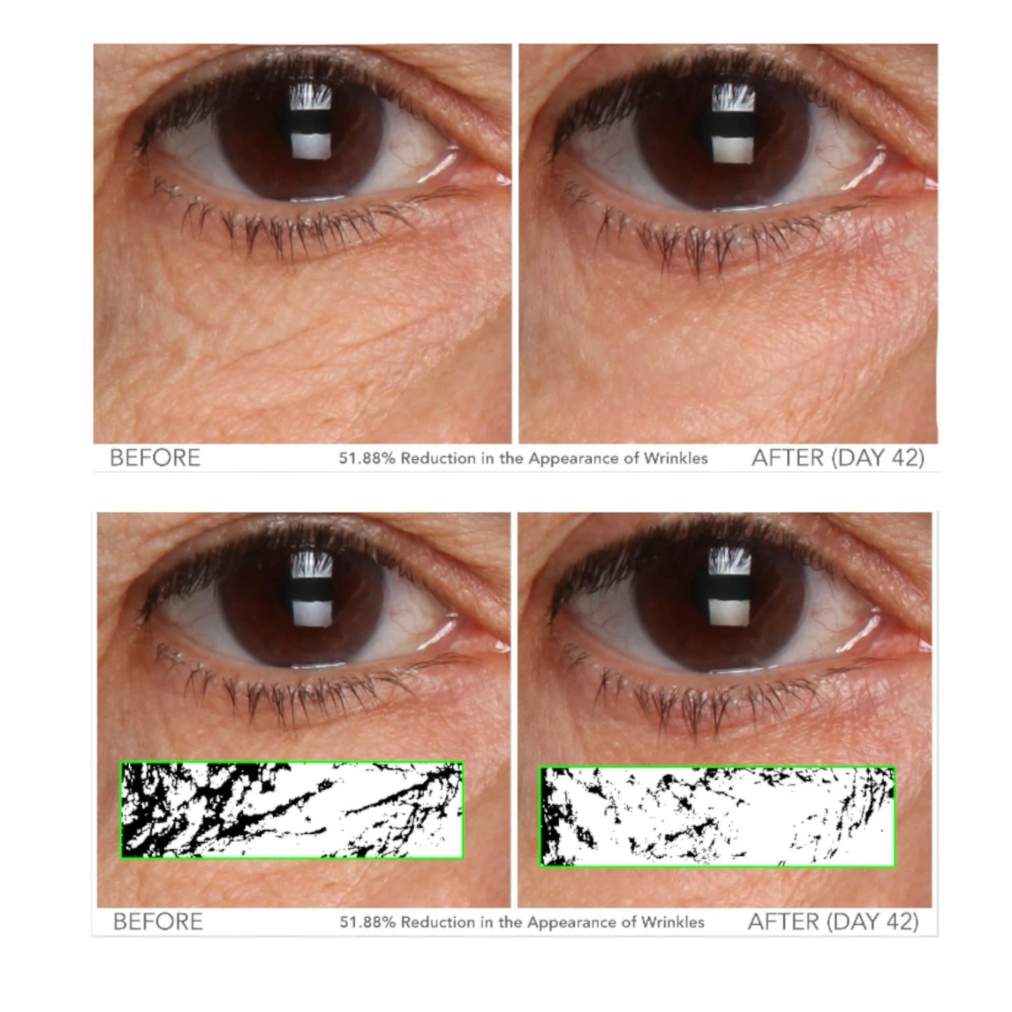 Serious Skincare - Vitamin C Eye Beauty Treatment Gel - Hyaluronic Acid & Collagen - For Undereye Lines, Wrinkles, Dark Circles - Hydrating & Soothing - C3 Plasma C Ester Biotechnology 0.5 oz.
